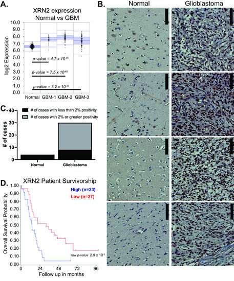 XRN2 Is Required for Cell Motility and Invasion in Glioblastomas XRN2 Is Required for Cell Motility and Invasion in Glioblastomas