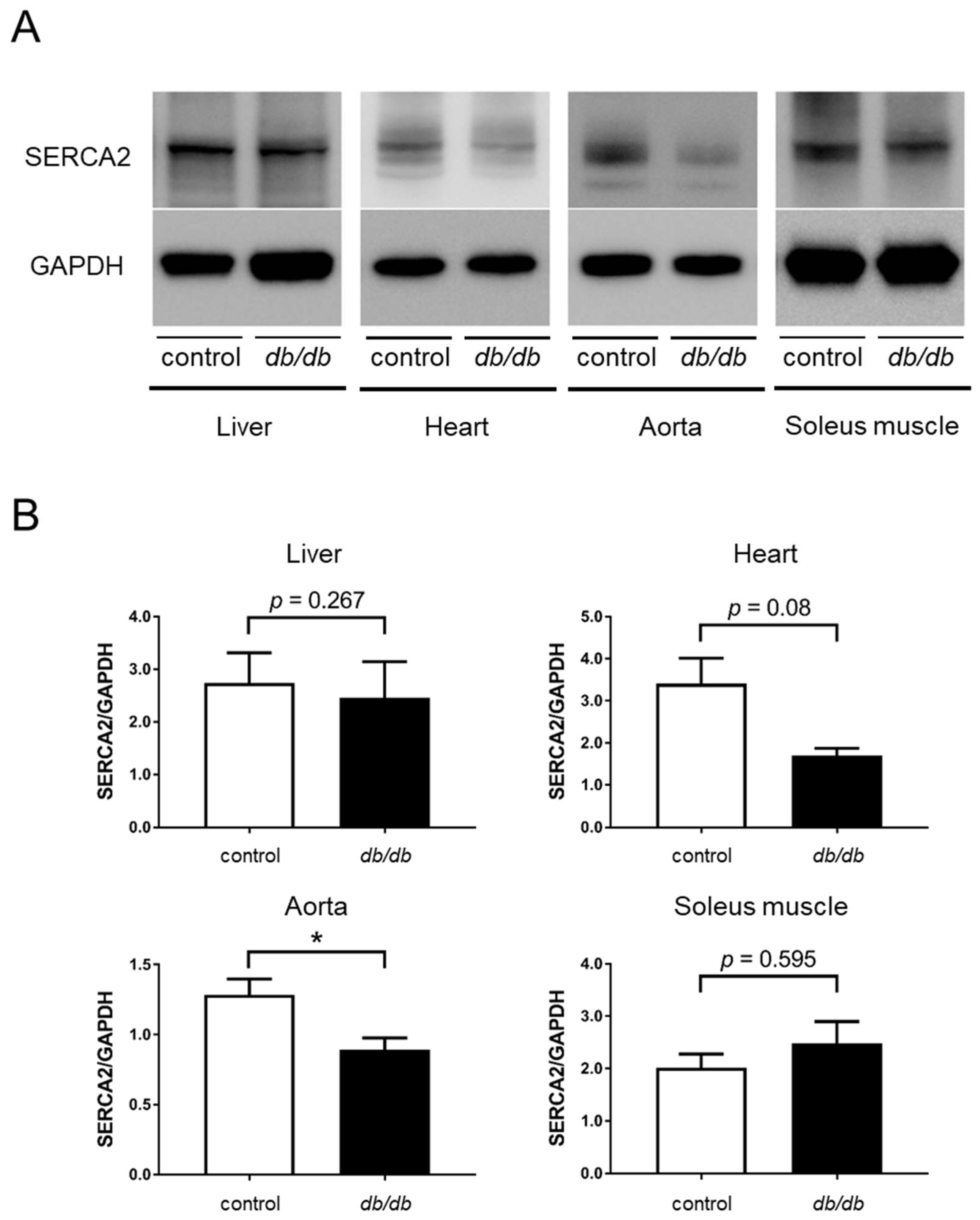 Cells | Free Full-Text | Sarco/Endoplasmic Reticulum Ca2+ ATPase 2  Activator Ameliorates Endothelial Dysfunction; Insulin Resistance in  Diabetic Mice