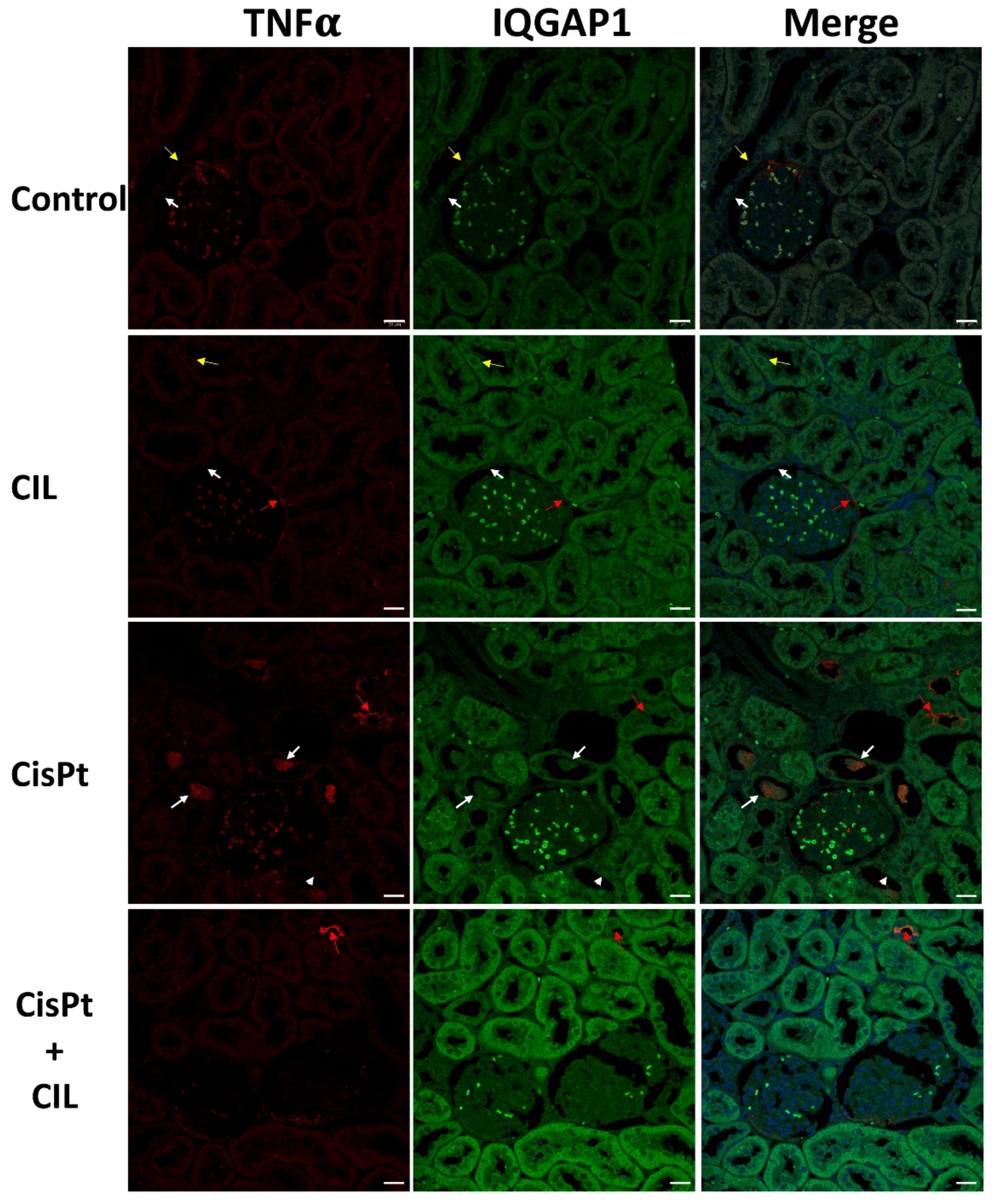 Cells 11 01585 g006 550