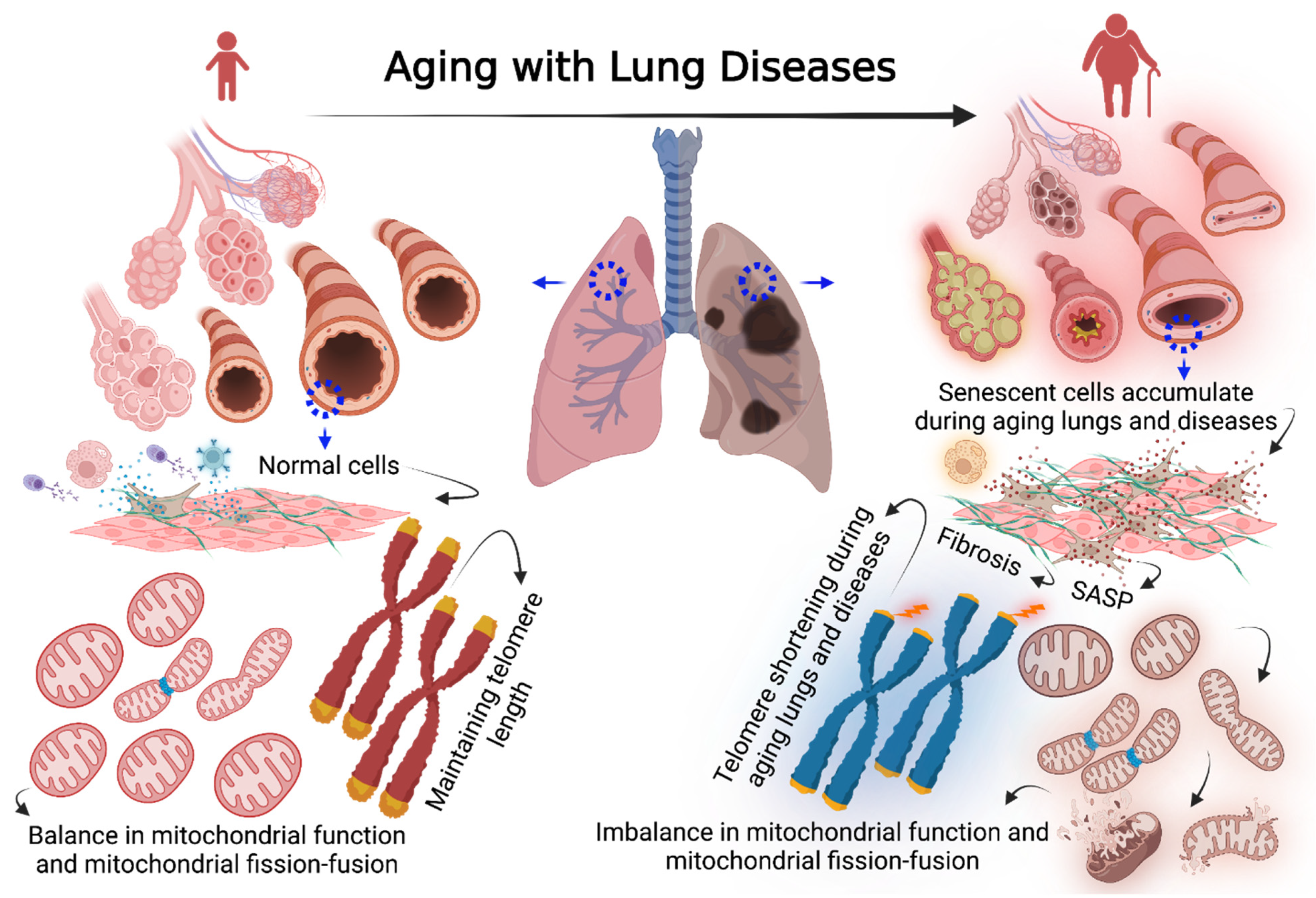 Cells | Free Full-Text | Cellular Senescence in Aging Lungs and Diseases Cells | Free Full-Text | Cellular Senescence in Aging Lungs and Diseases