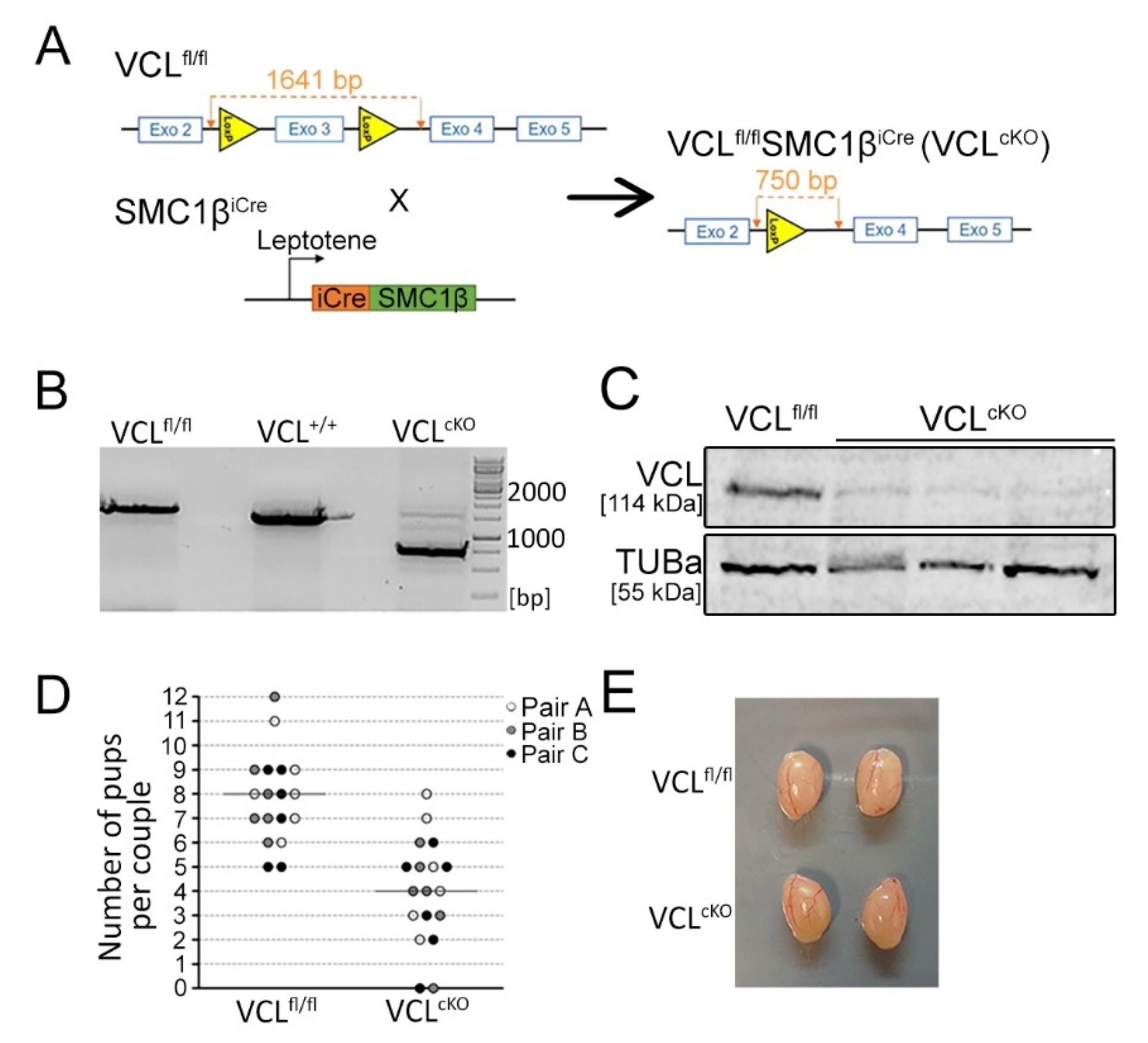 Cells Free Full-Text Focal Adhesion Protein Vinculin Is Required for Proper Meiotic Progression during Mouse Spermatogenesis