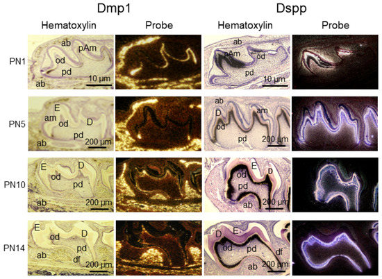 BMP Signaling Pathway in Dentin Development and Diseases