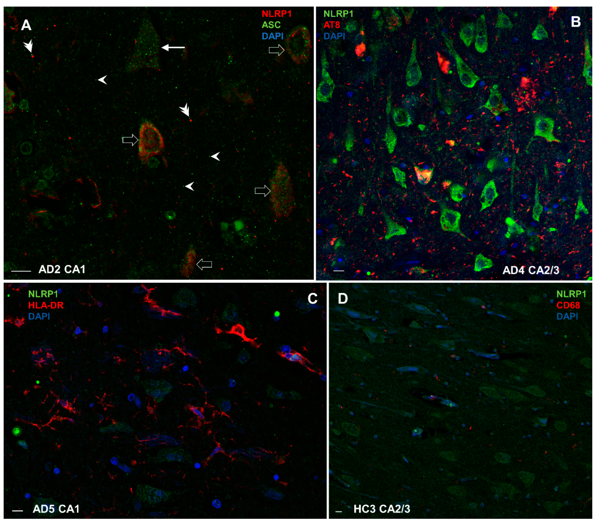 Cells 11 02223 g011 Cells 11 02223 g011