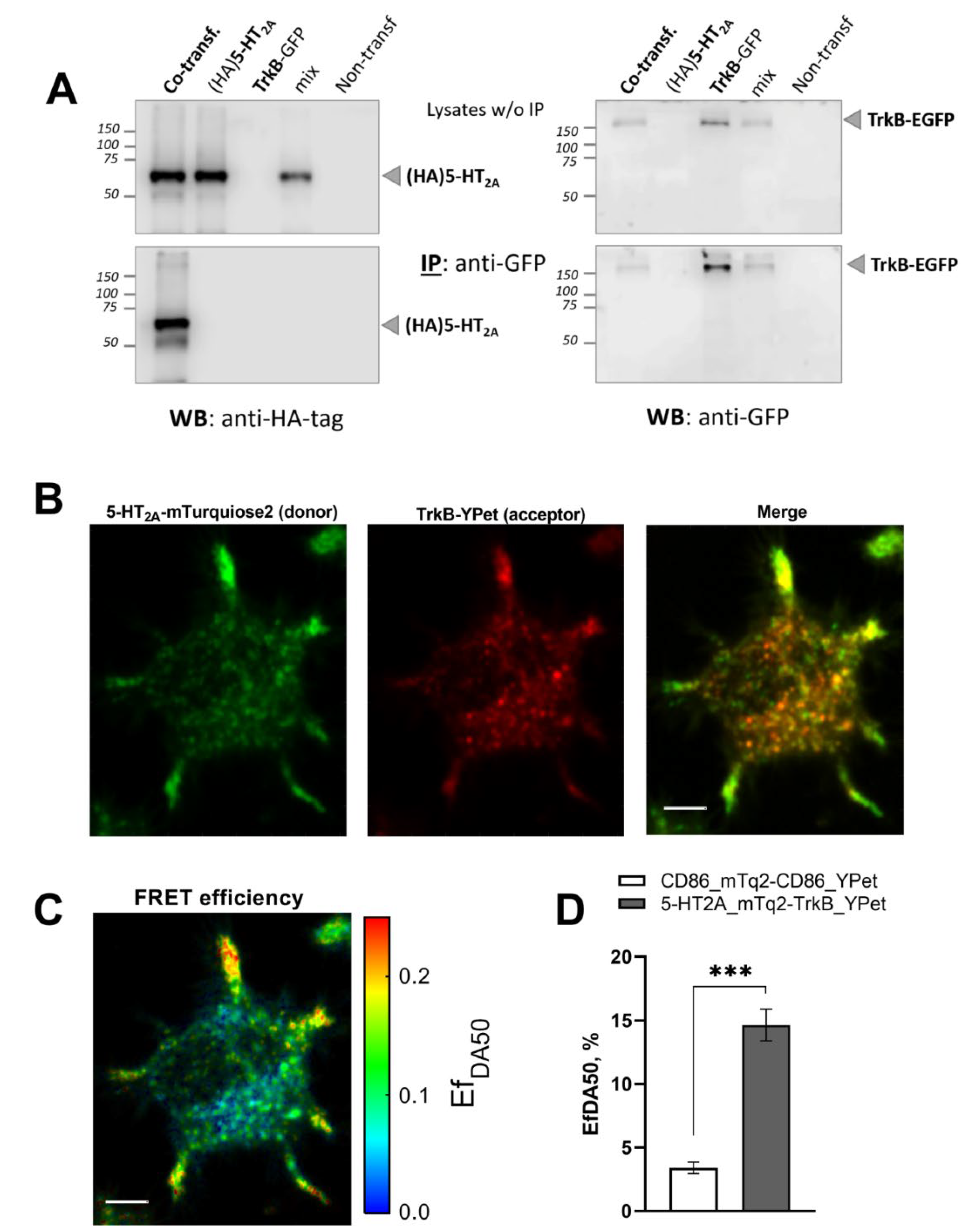 1st studio siberian mouse custom  Serotonin Receptor 5-HT2A Regulates TrkB Receptor Function in  Heteroreceptor Complexes