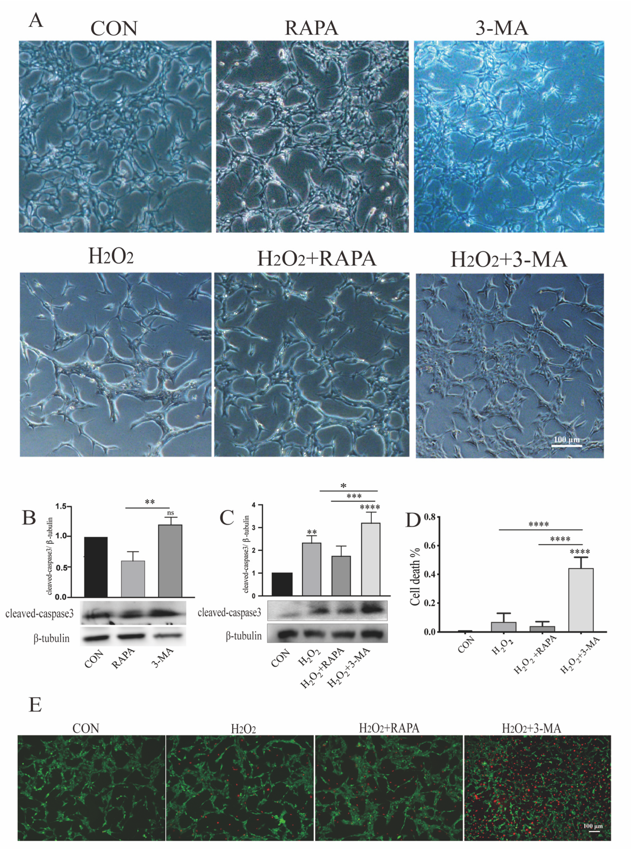Autophagy in Rat Müller Glial Cells Is Modulated by the