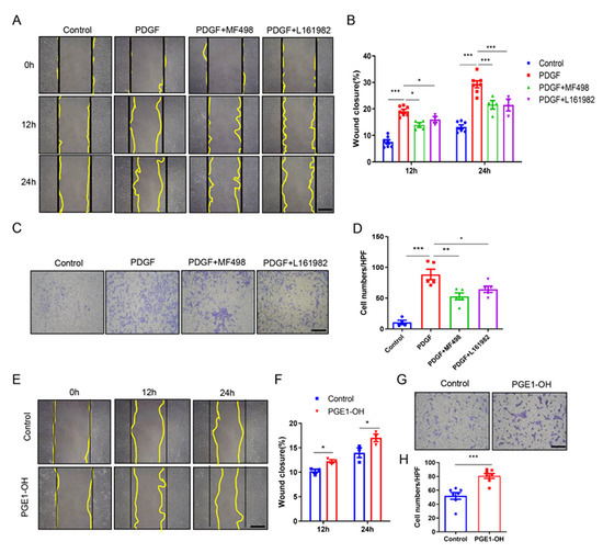 The Prostaglandin E2 Receptor EP4 Promotes Vascular