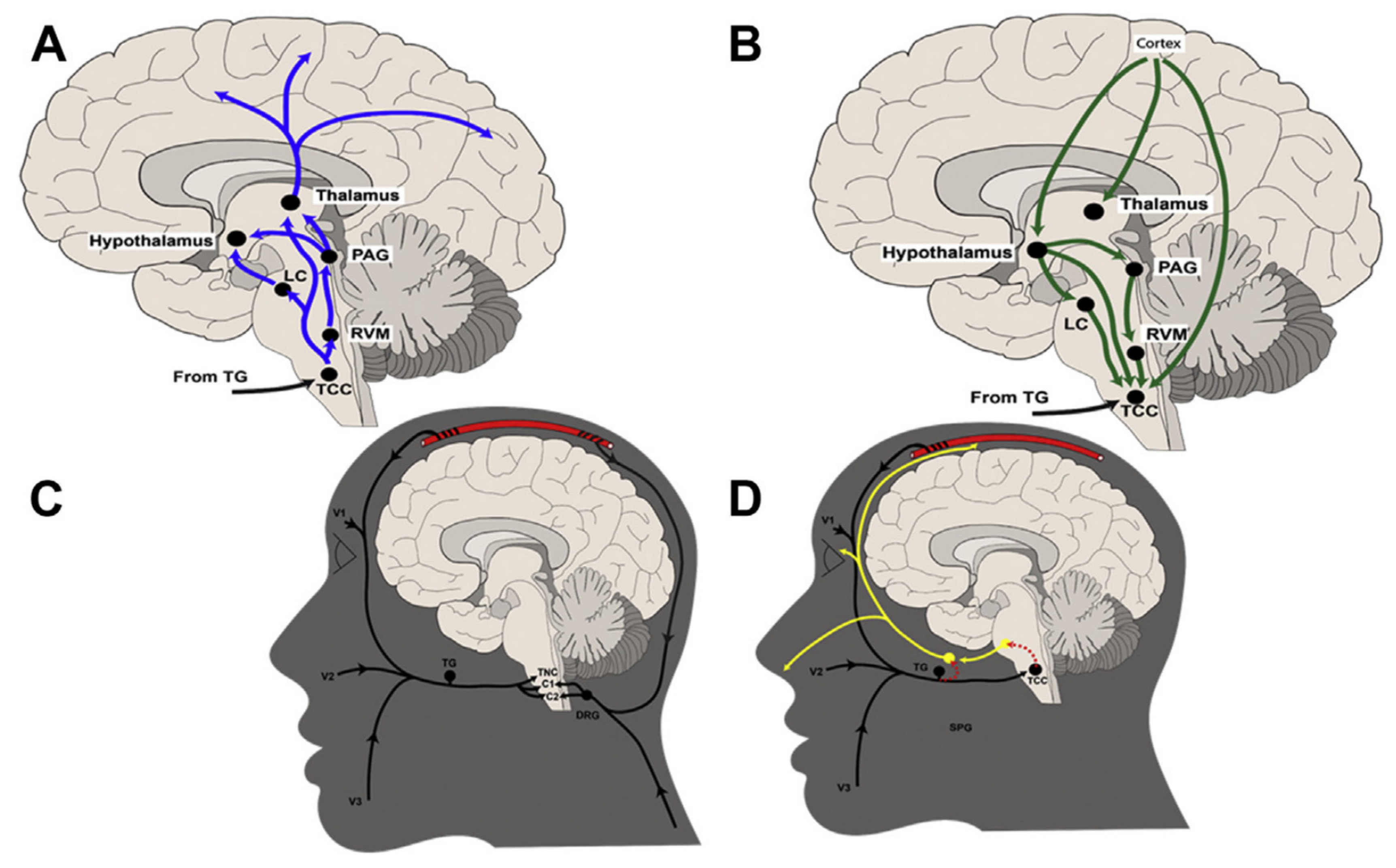 PDF) Vestibular migraine may be an important cause of dizziness/vertigo in  perimenopausal period
