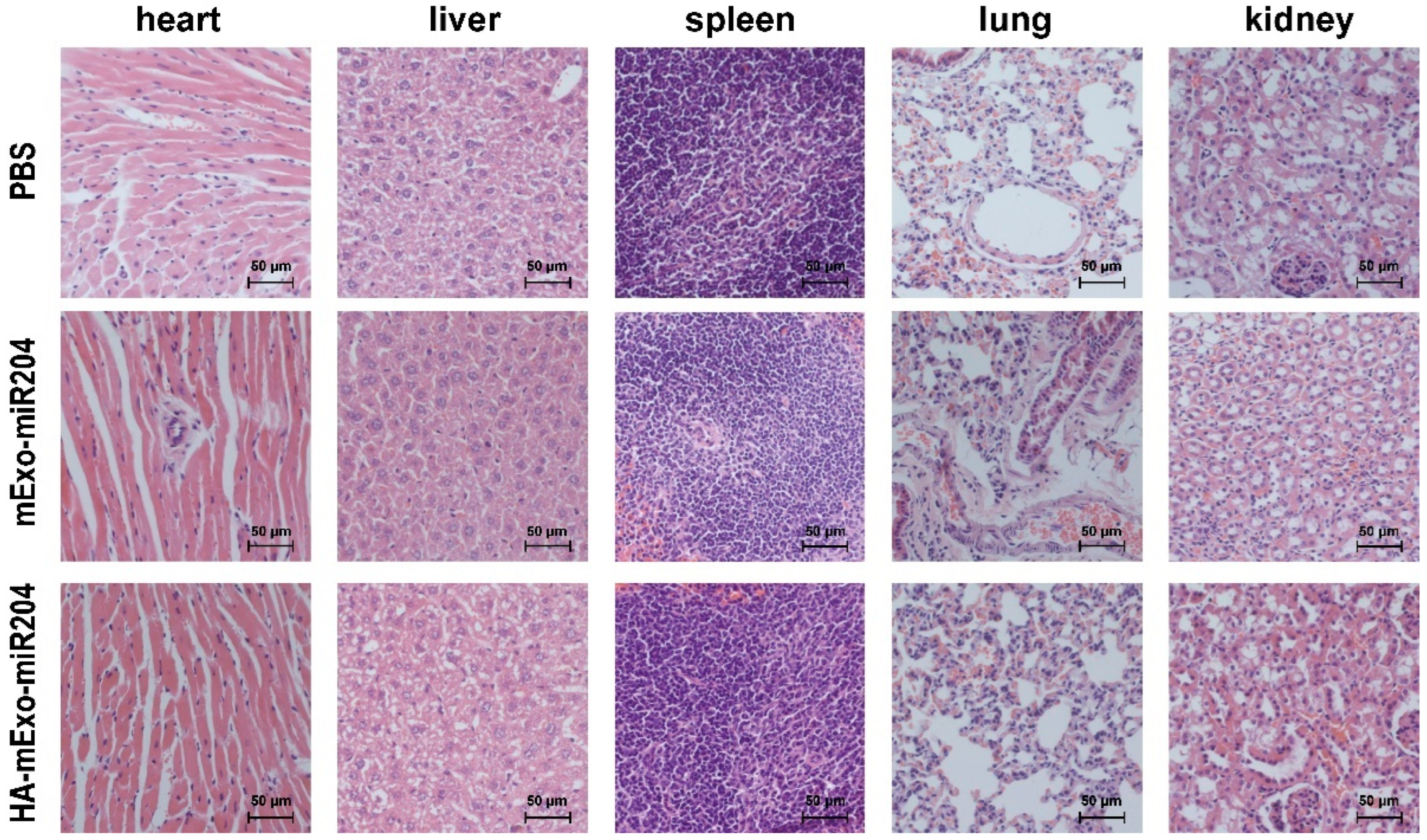 Hyaluronic Acid-Coated Bovine Milk Exosomes for Achieving