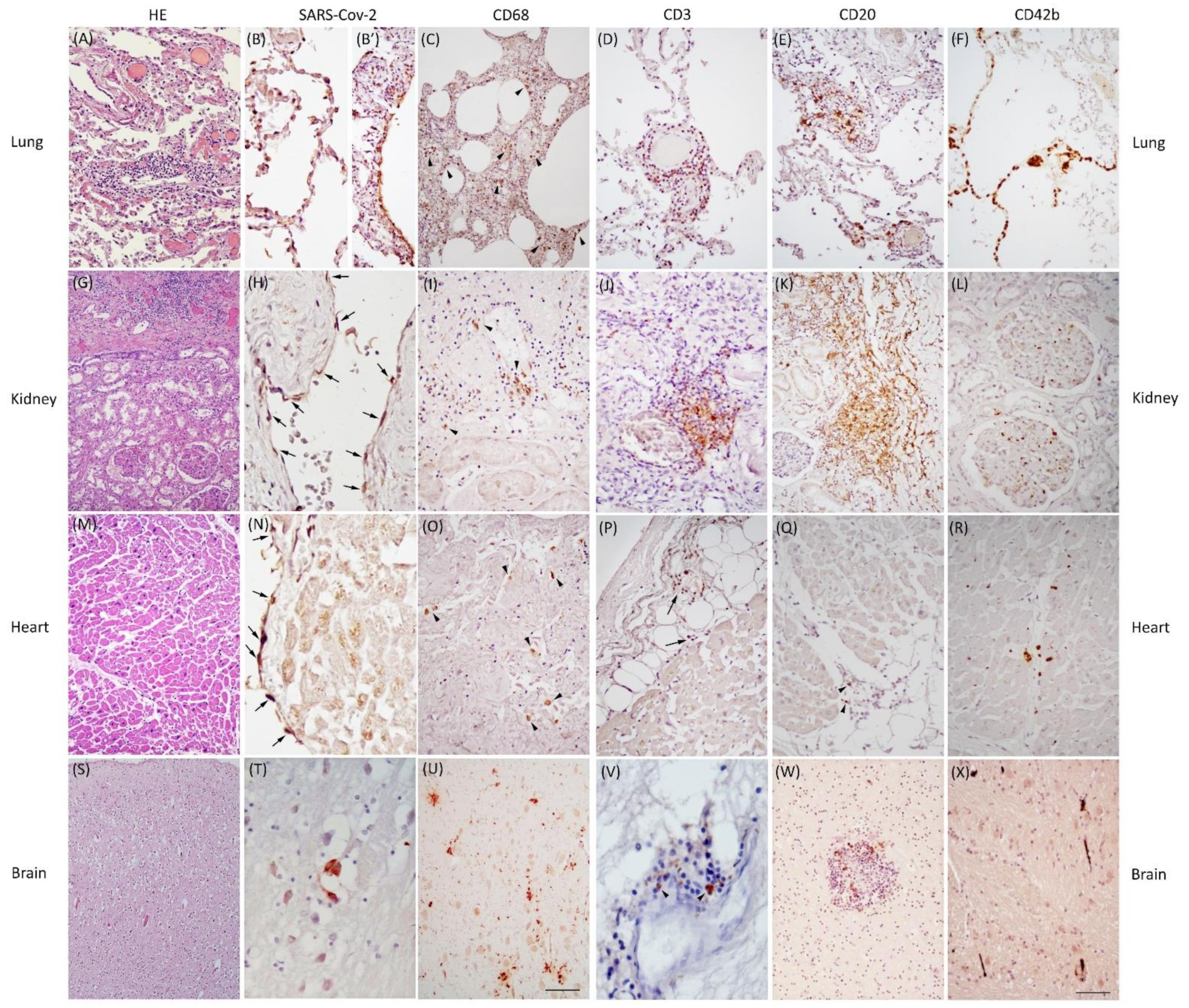 Cells 11 03124 g001 Cells 11 03124 g001