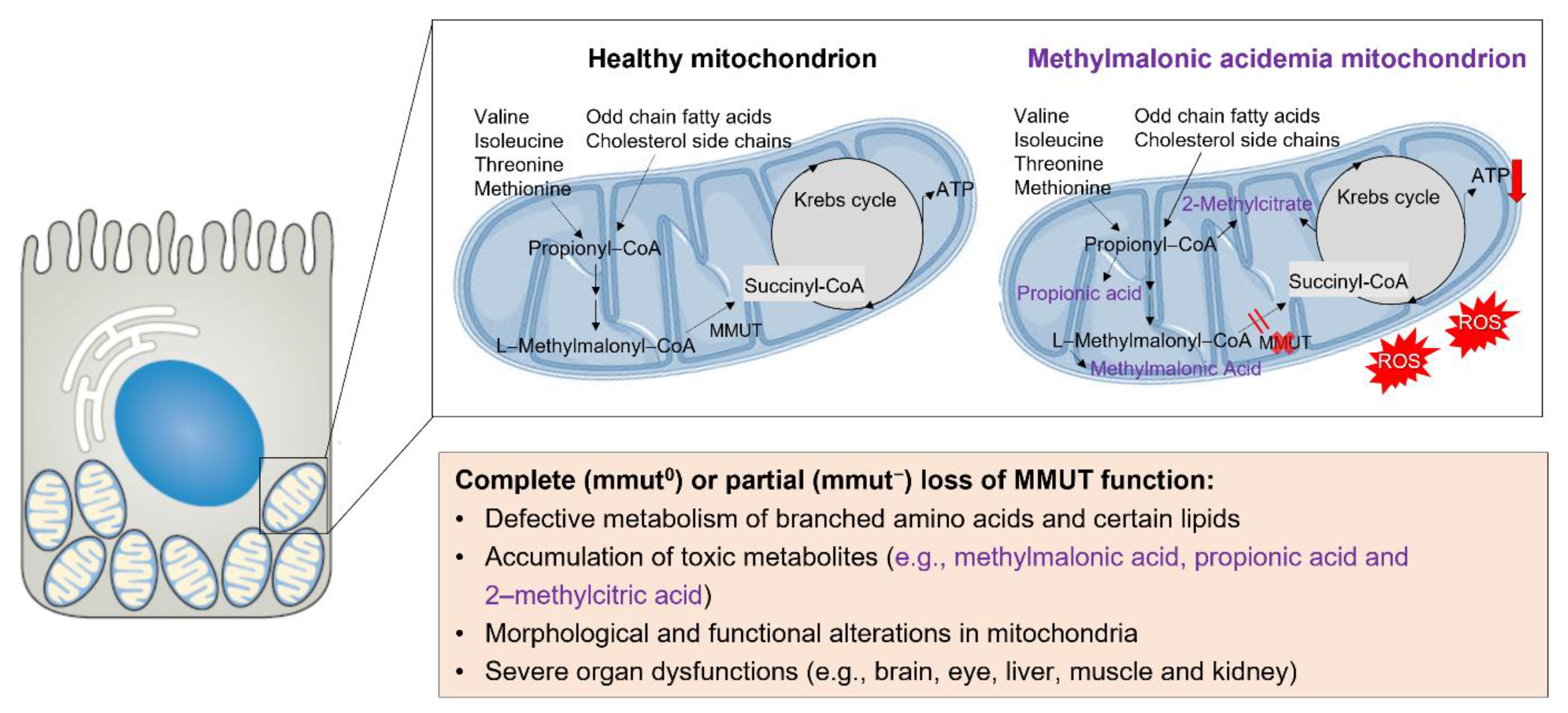 Mitochondrial Distress in Methylmalonic Acidemia: Novel Mitochondrial Distress in Methylmalonic Acidemia: Novel