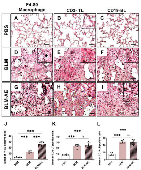 A New Model of Acute Exacerbation of Experimental Pulmonary Fibrosis in ...