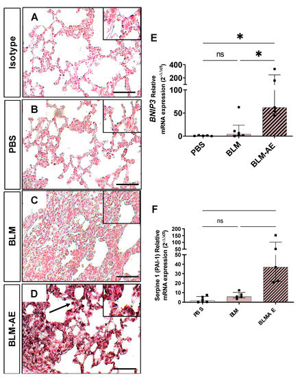 A New Model of Acute Exacerbation of Experimental Pulmonary Fibrosis in ...