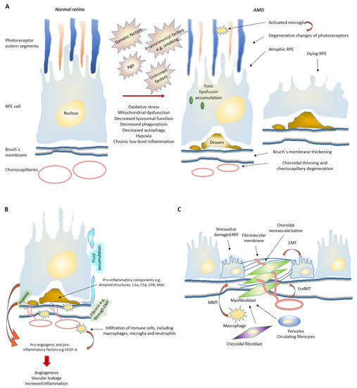 A Linkage between Angiogenesis and Inflammation in