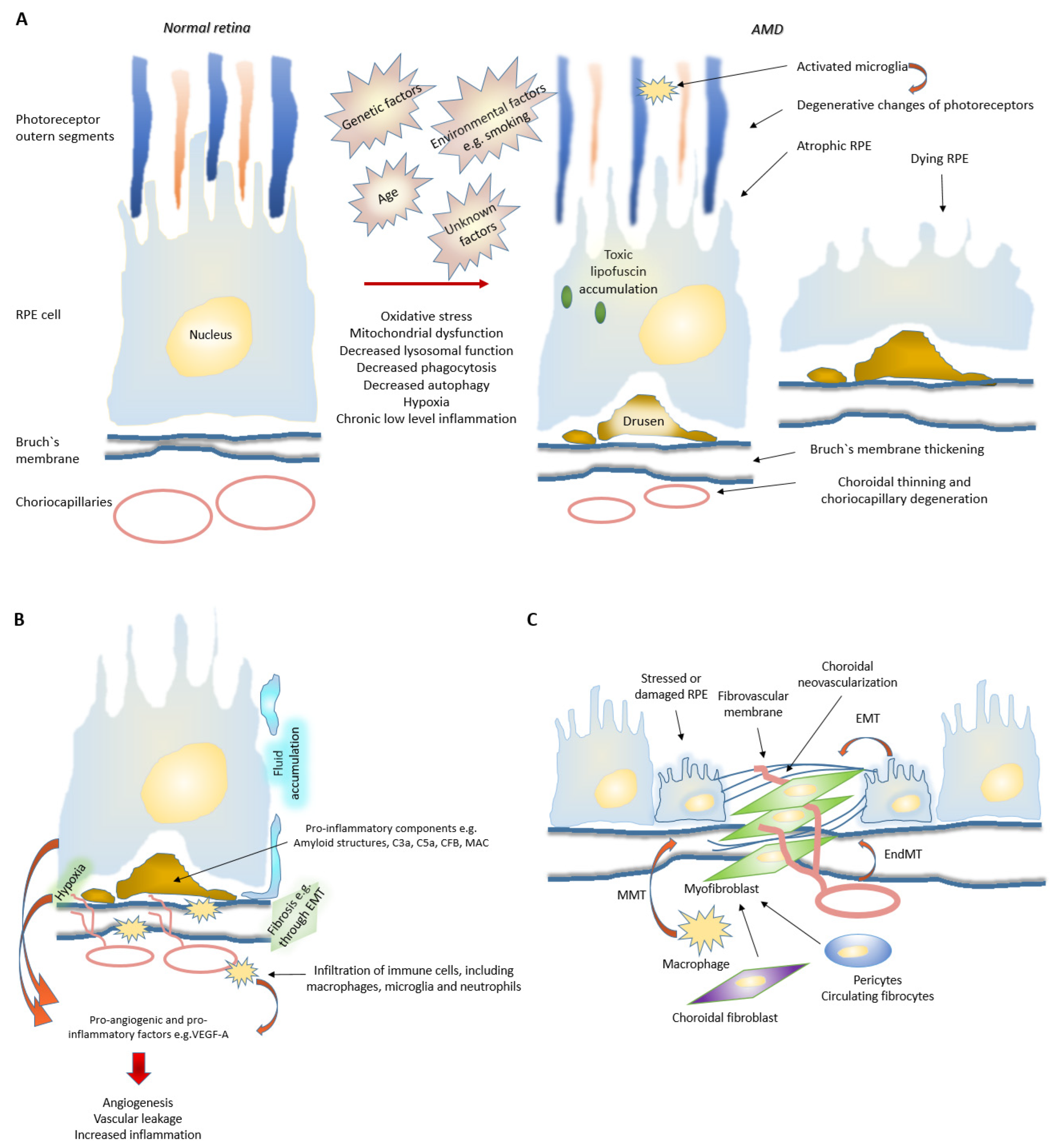 Ａｎｇｉｏｌｏｇｙ　Ｆｒｏｎｔｉｅｒ １４-２/メディカルレビュ-社/『Ａｎｇｉｏｌｏｇｙ　Ｆｒｏｎｔｉｅｒ』（単行本） Understanding role of Ang2 in neovascular AMD