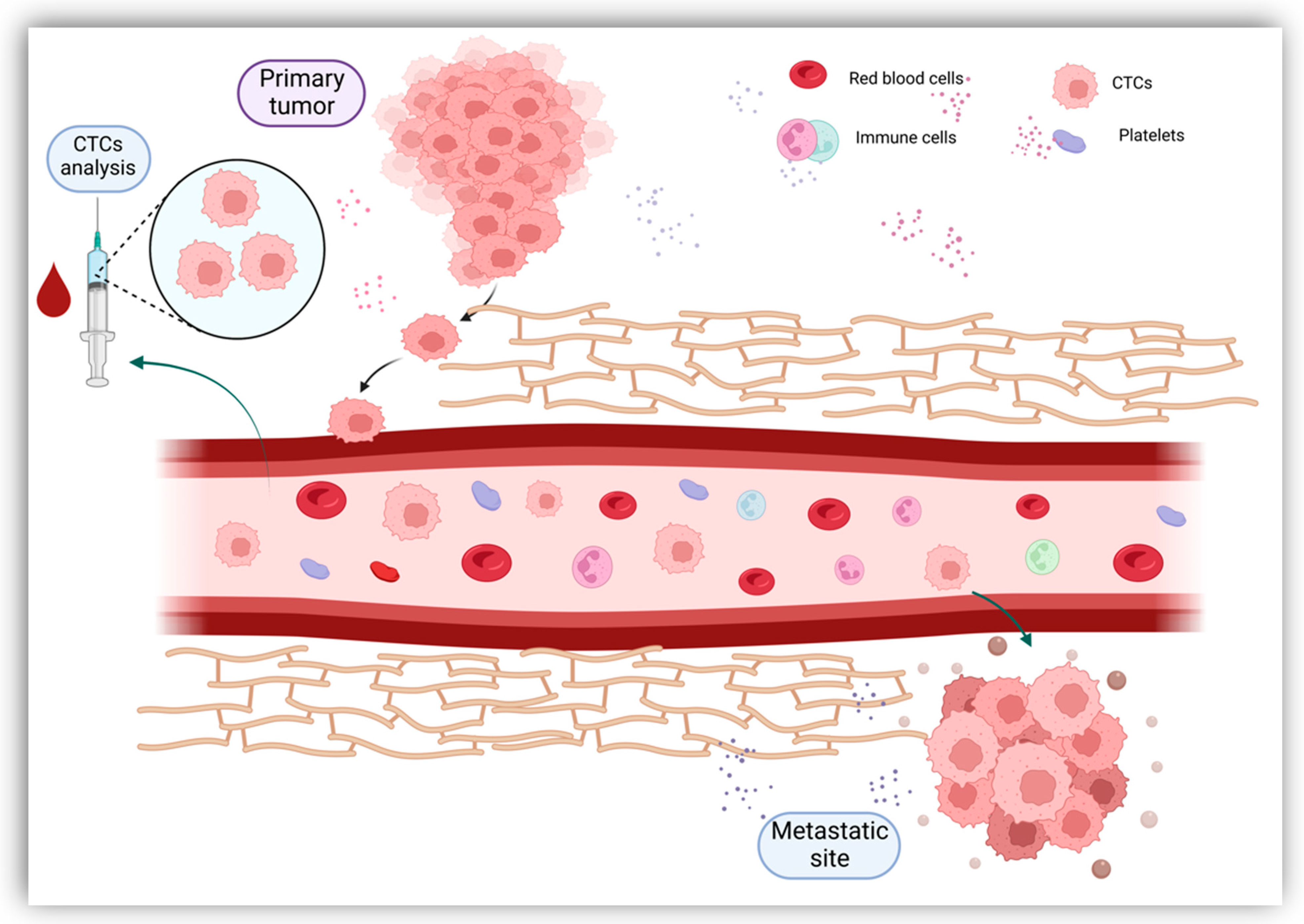 Cells | Free Full-Text | Clinical Applications of Liquid Biopsy in 