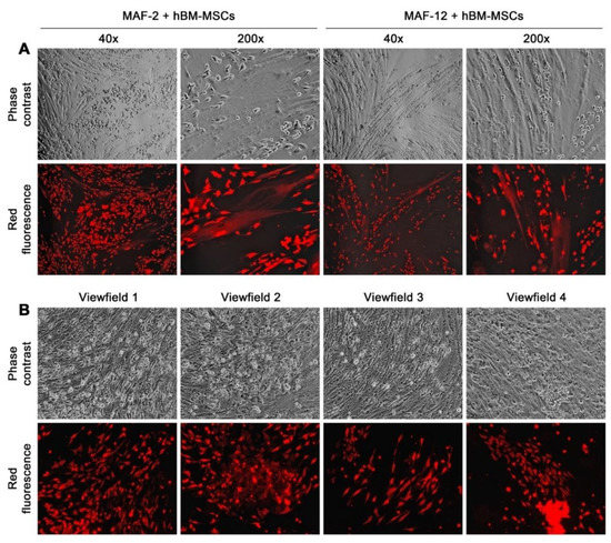 Breast Cancer MCF-7 Cells Acquire Heterogeneity during Successive Co ...