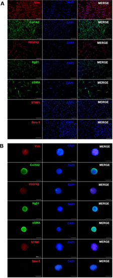 Ultrastructural Characterization of Human Gingival Fibroblasts in 3D ...