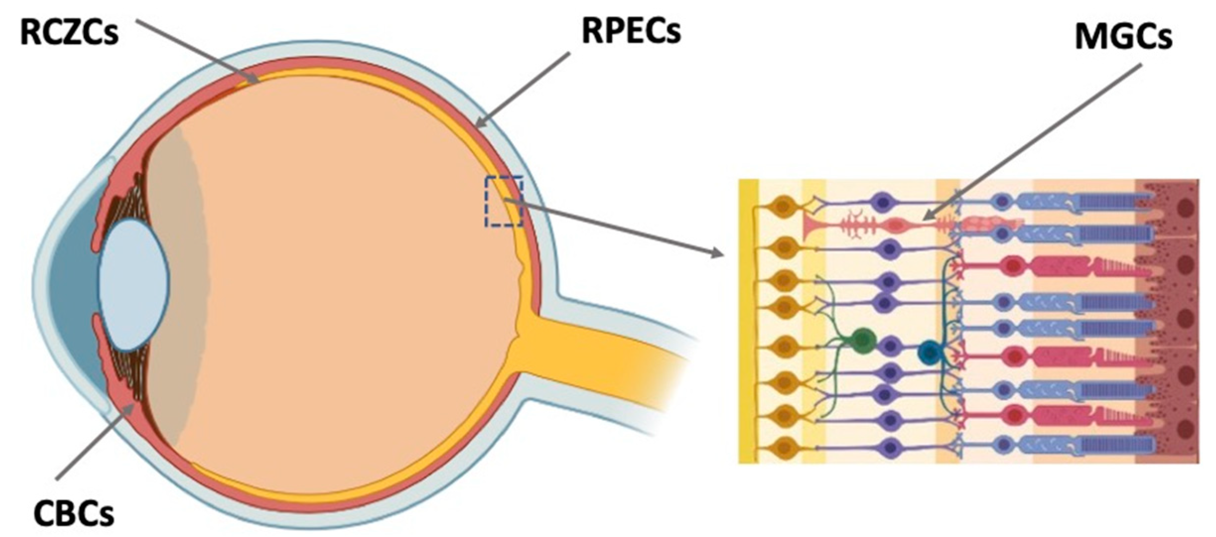 Eye and Vision Conditions – Wohl Optics