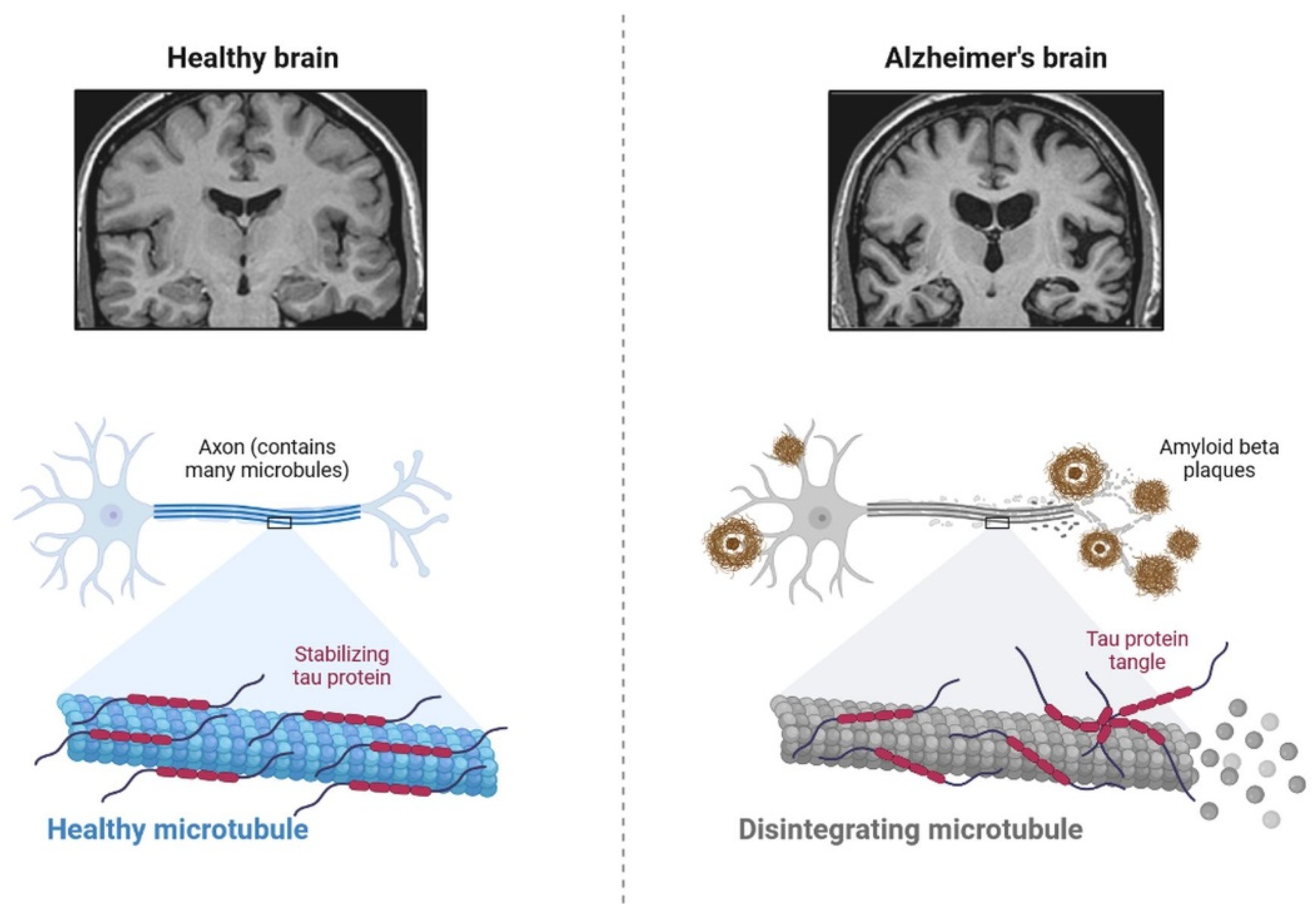 Cells 11 03767 g007 Cells 11 03767 g007