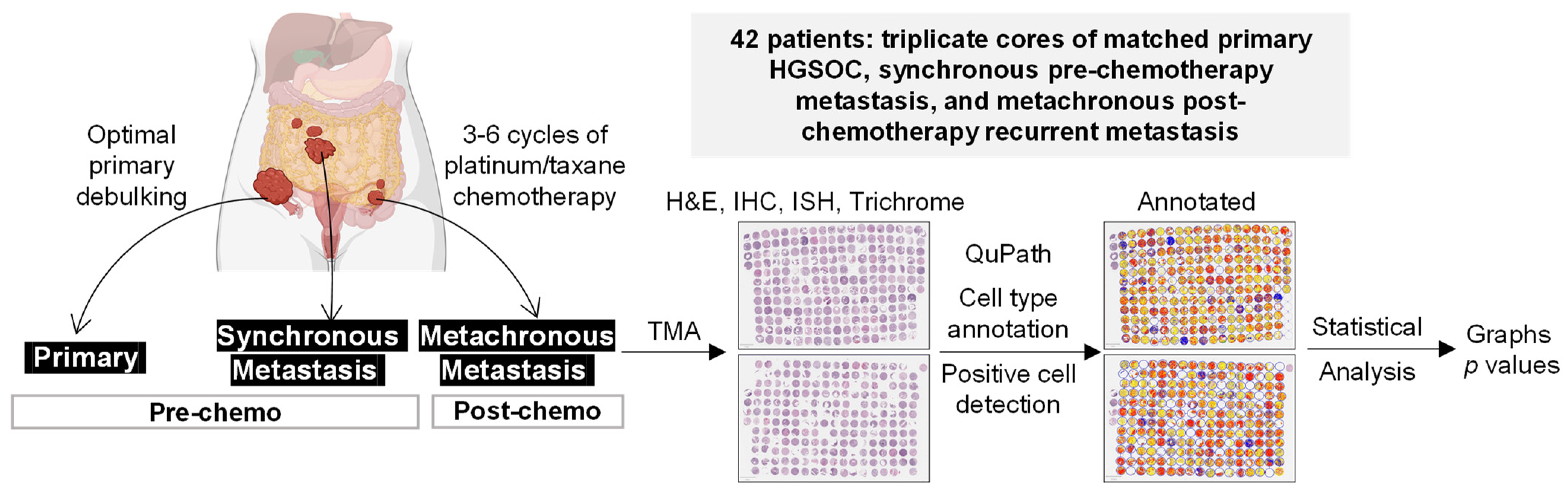 Cells Free Full-Text Dynamic Changes in the Extracellular Matrix in Primary, Metastatic, and Recurrent Ovarian Cancers