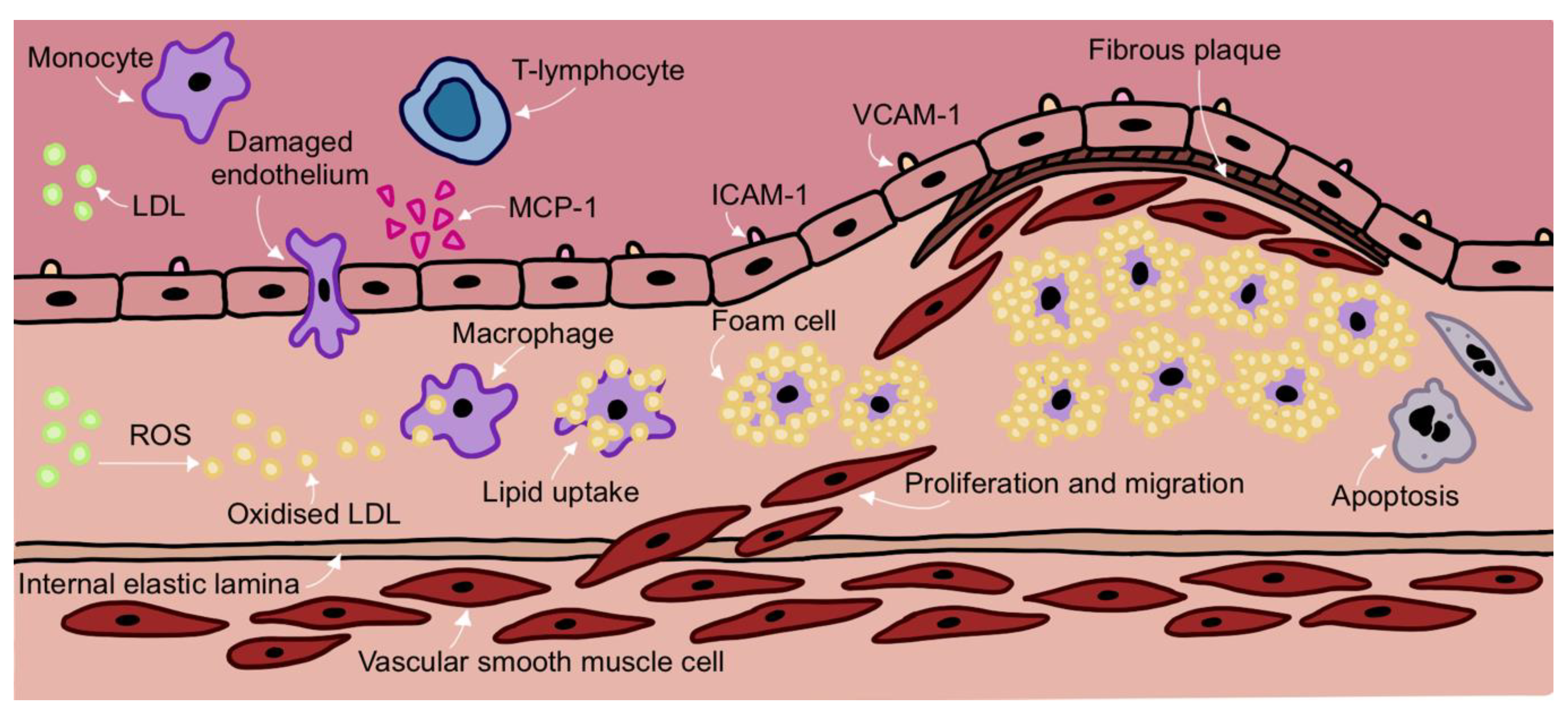 Frontiers  Characteristics and evaluation of atherosclerotic plaques: an  overview of state-of-the-art techniques