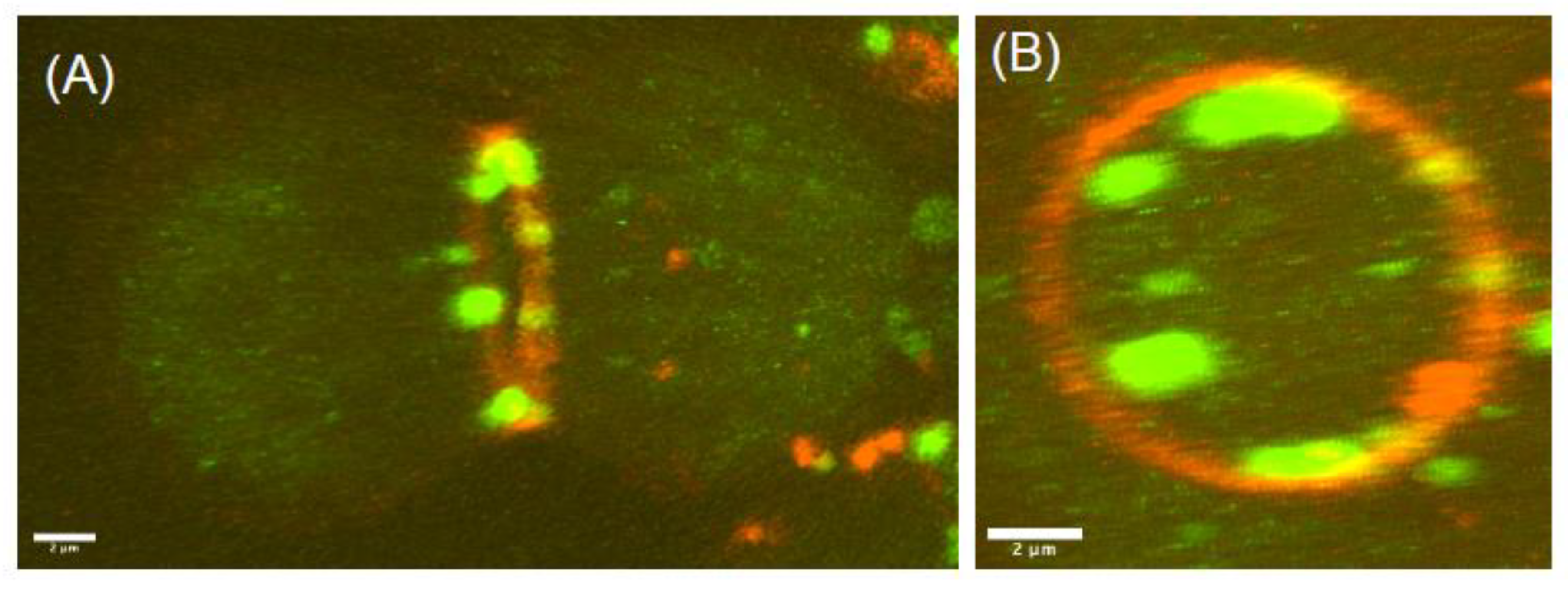 Cells | Free Full-Text | Lipid Polarization during Cytokinesis