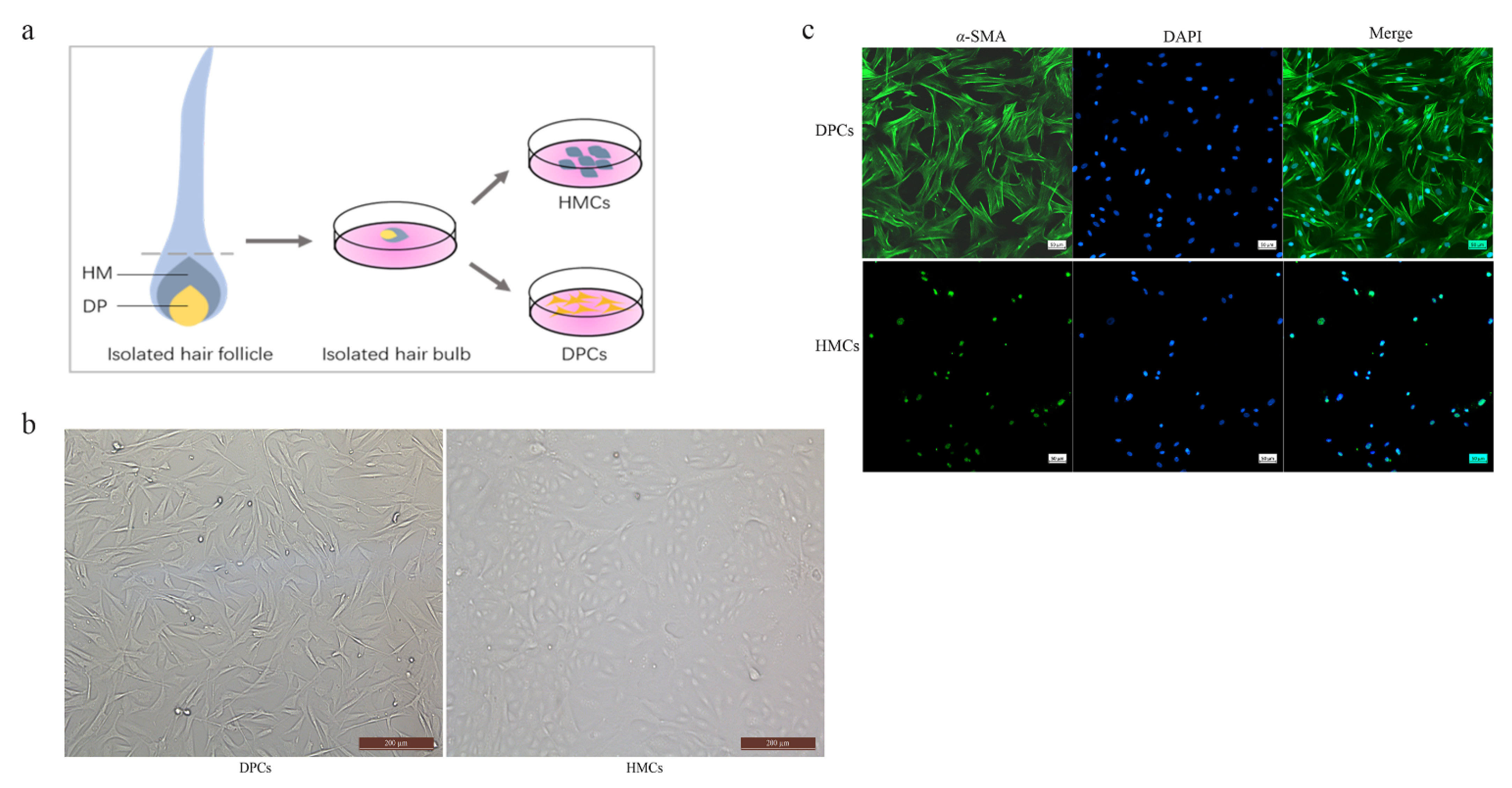 Cells | Free Full-Text | Comparative Analysis of mRNA and miRNA Expression  between Dermal Papilla Cells and Hair Matrix Cells of Hair Follicles in Yak