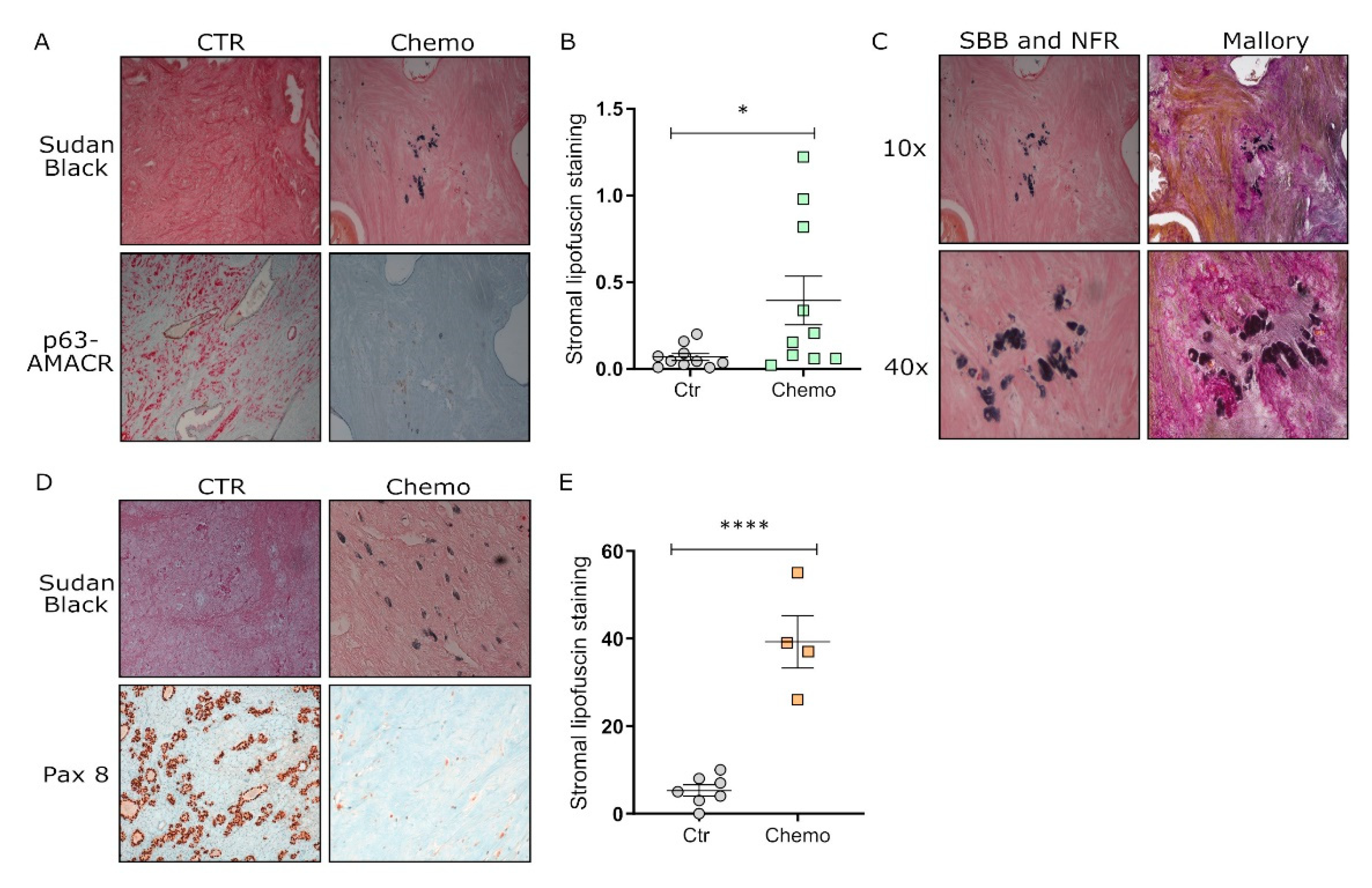 Therapy-Induced Stromal Senescence Promoting Aggressiveness Therapy-Induced Stromal Senescence Promoting Aggressiveness