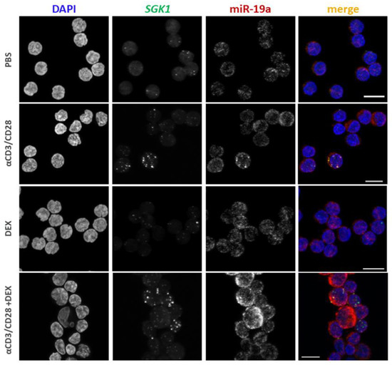 The Serum/Glucocorticoid-Regulated Kinase 1 Is Targeted by