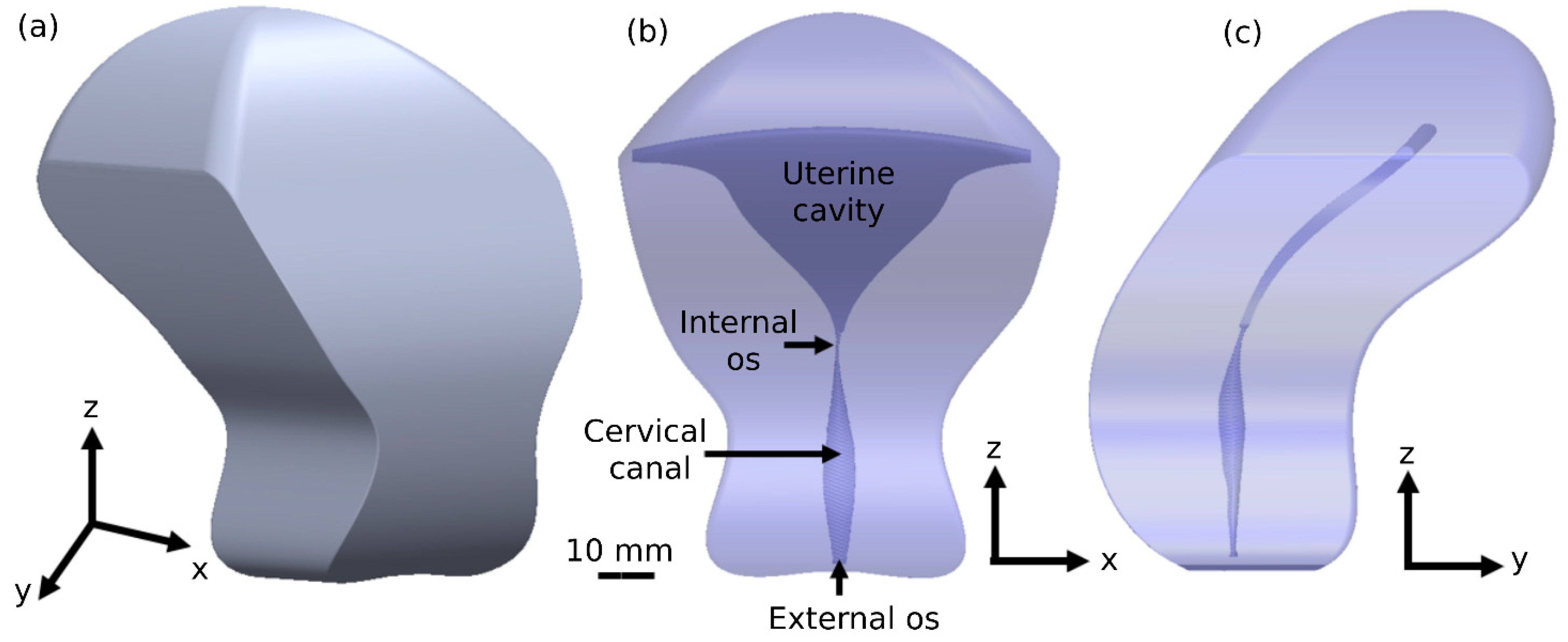 Cells Free Full-Text Dynamic 3D Modeling for Human Sperm Motility through the Female Cervical Canal and Uterine Cavity to Predict Sperm Chance of Reaching the Oocyte photo
