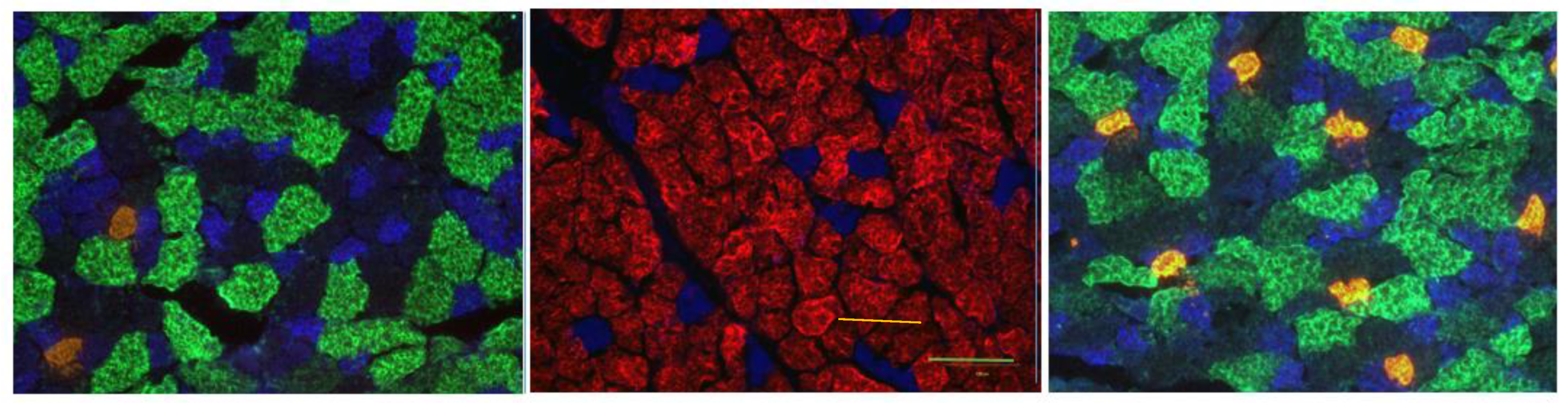 Cells 12 00361 g004 Cells 12 00361 g004