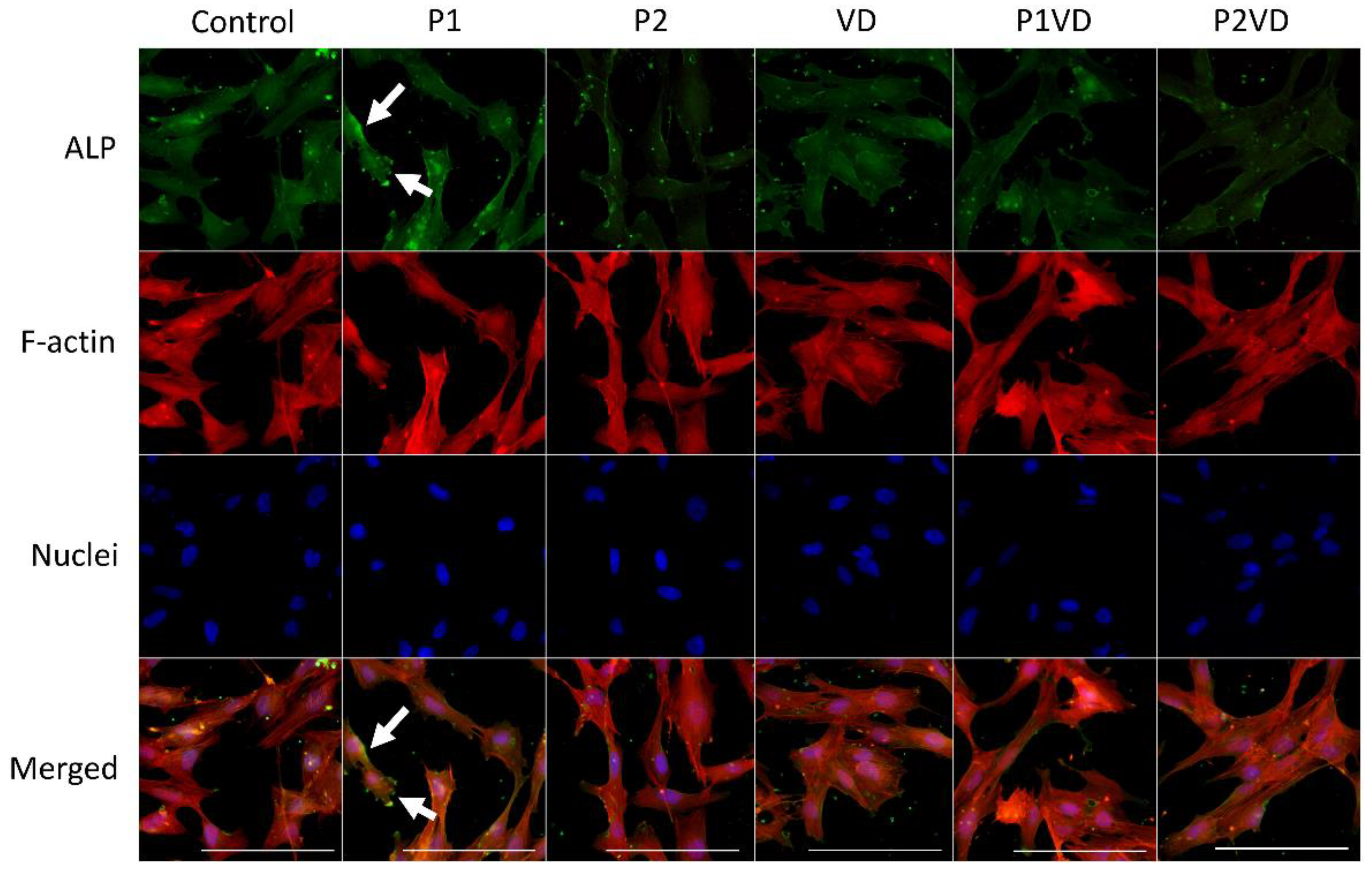 Cells 12 00364 g004 Cells 12 00364 g004