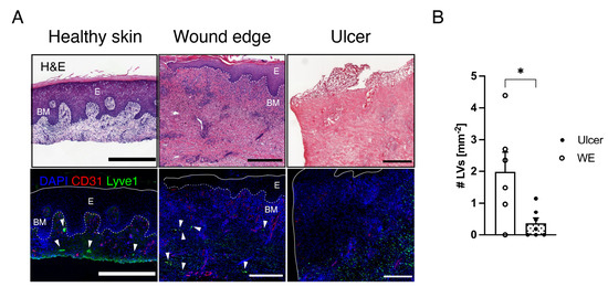 治癒の病理 = Pathology of Wound Healing 裁断済み Promotion of Lymphangiogenesis by Targeted Delivery of VEGF