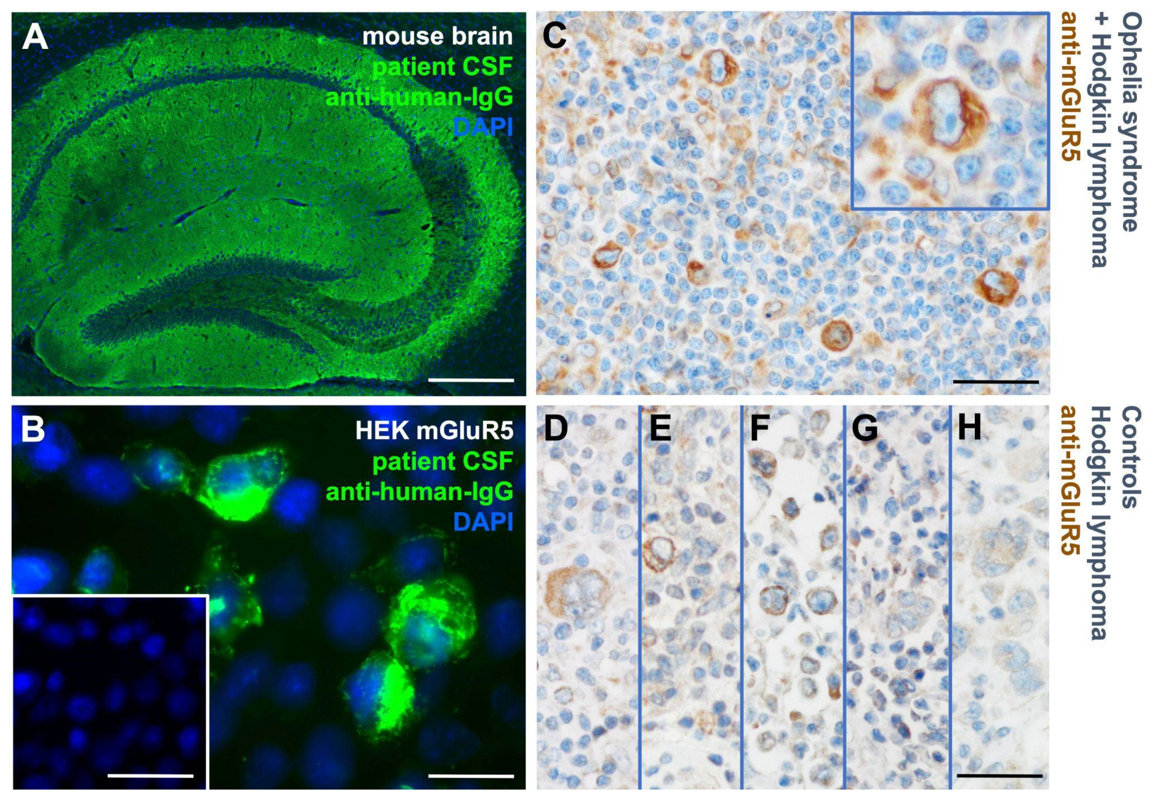 器官病理学 = Organ Pathology IgG4-related disease - The Lancet