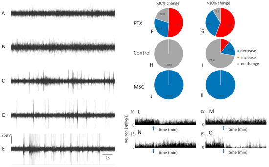 Functional Deficiency of Interneurons and Negative BOLD fMRI Response