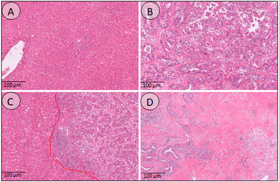Expression of Checkpoint Molecules in the Tumor Microenvironment of ... Biology Diagrams