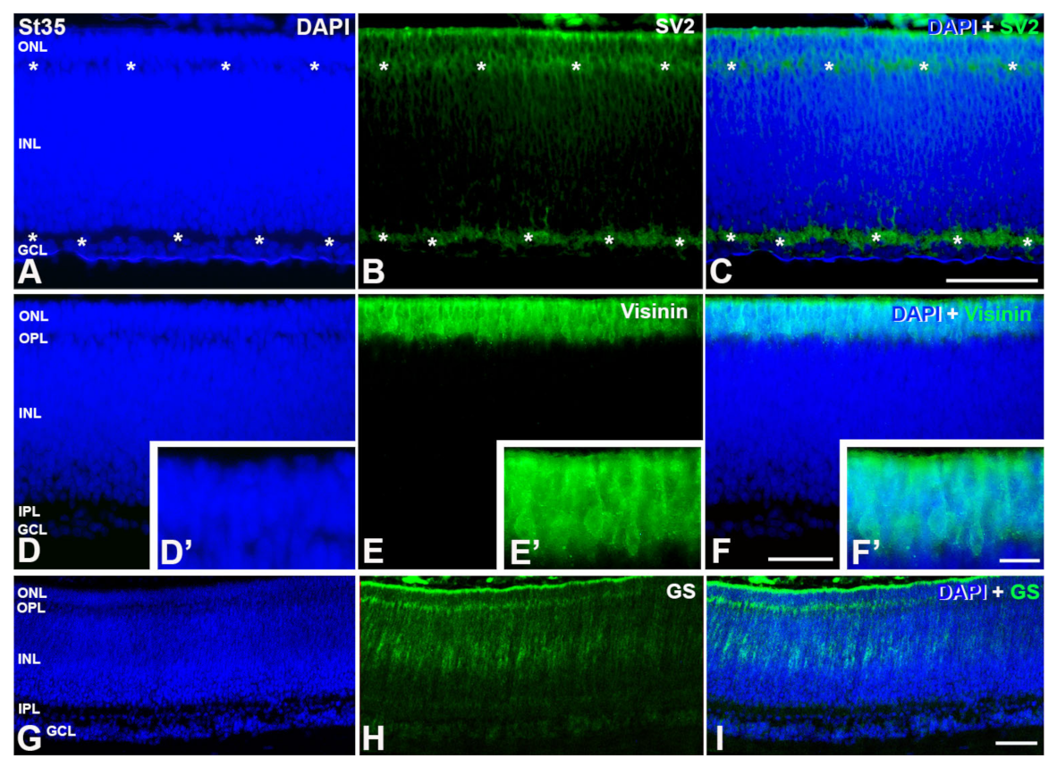 Cells 12 00989 g006 Cells 12 00989 g006