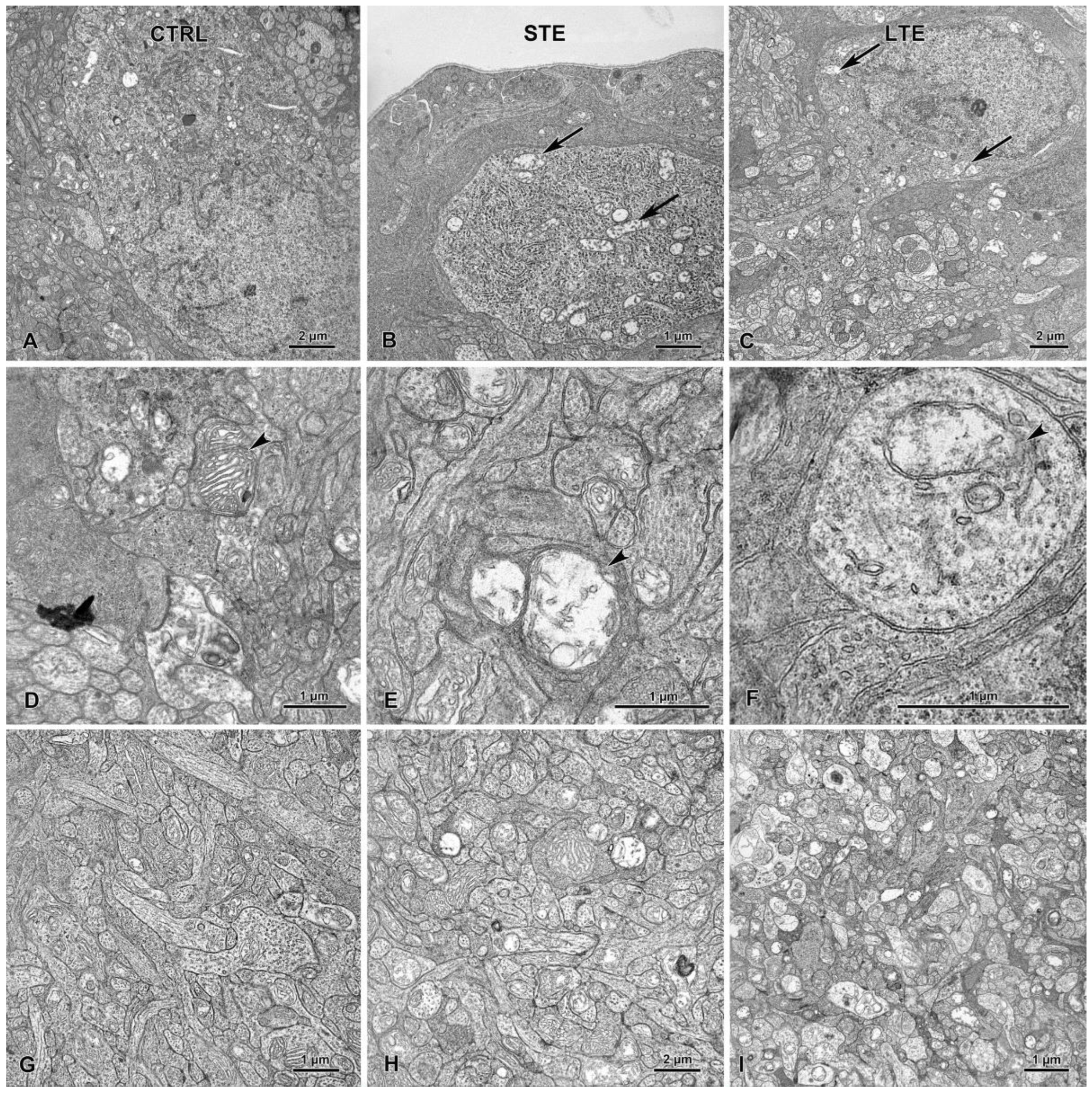 Cells 12 01014 g011 Cells 12 01014 g011