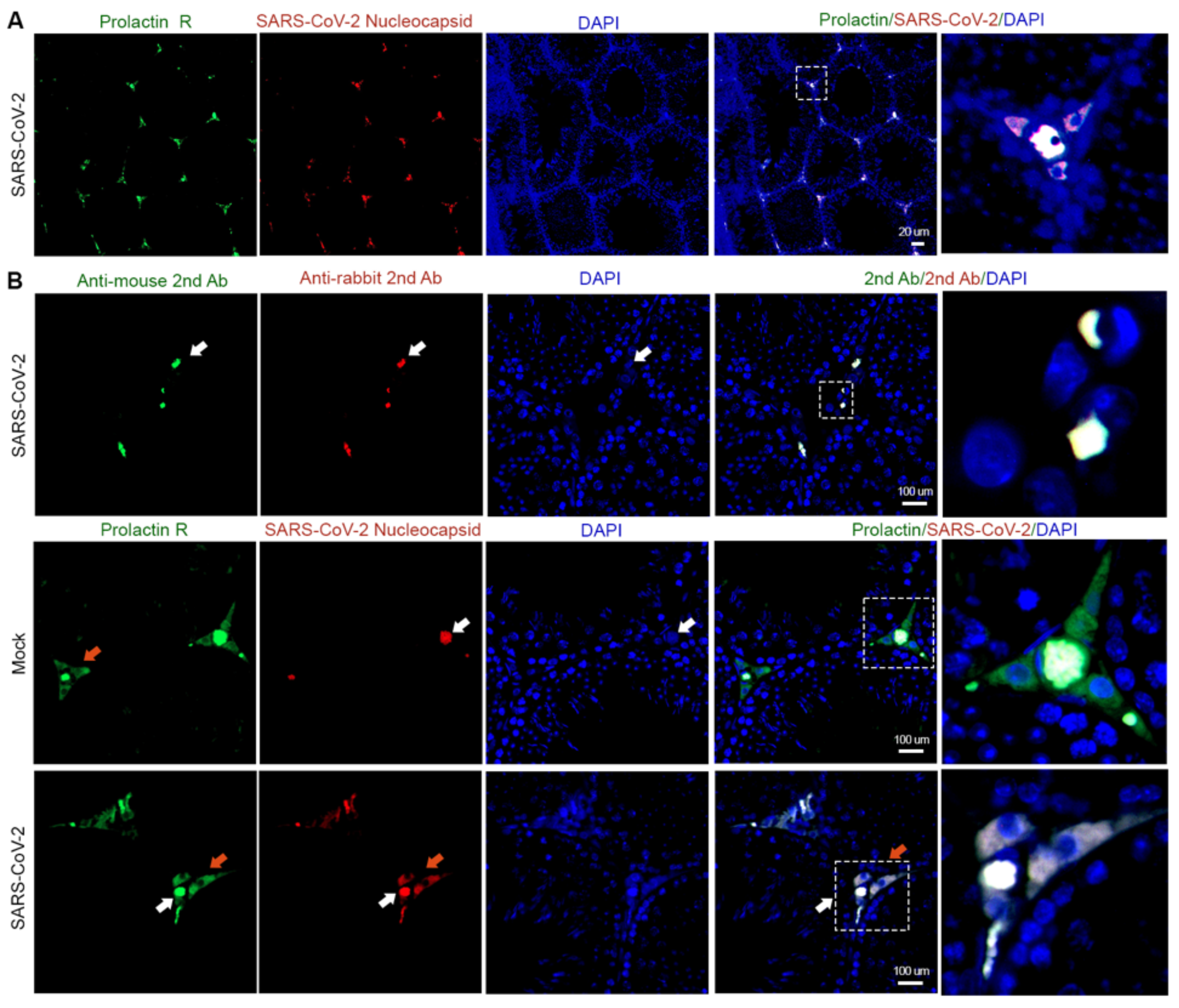 Cells 12 01198 g001 Cells 12 01198 g001