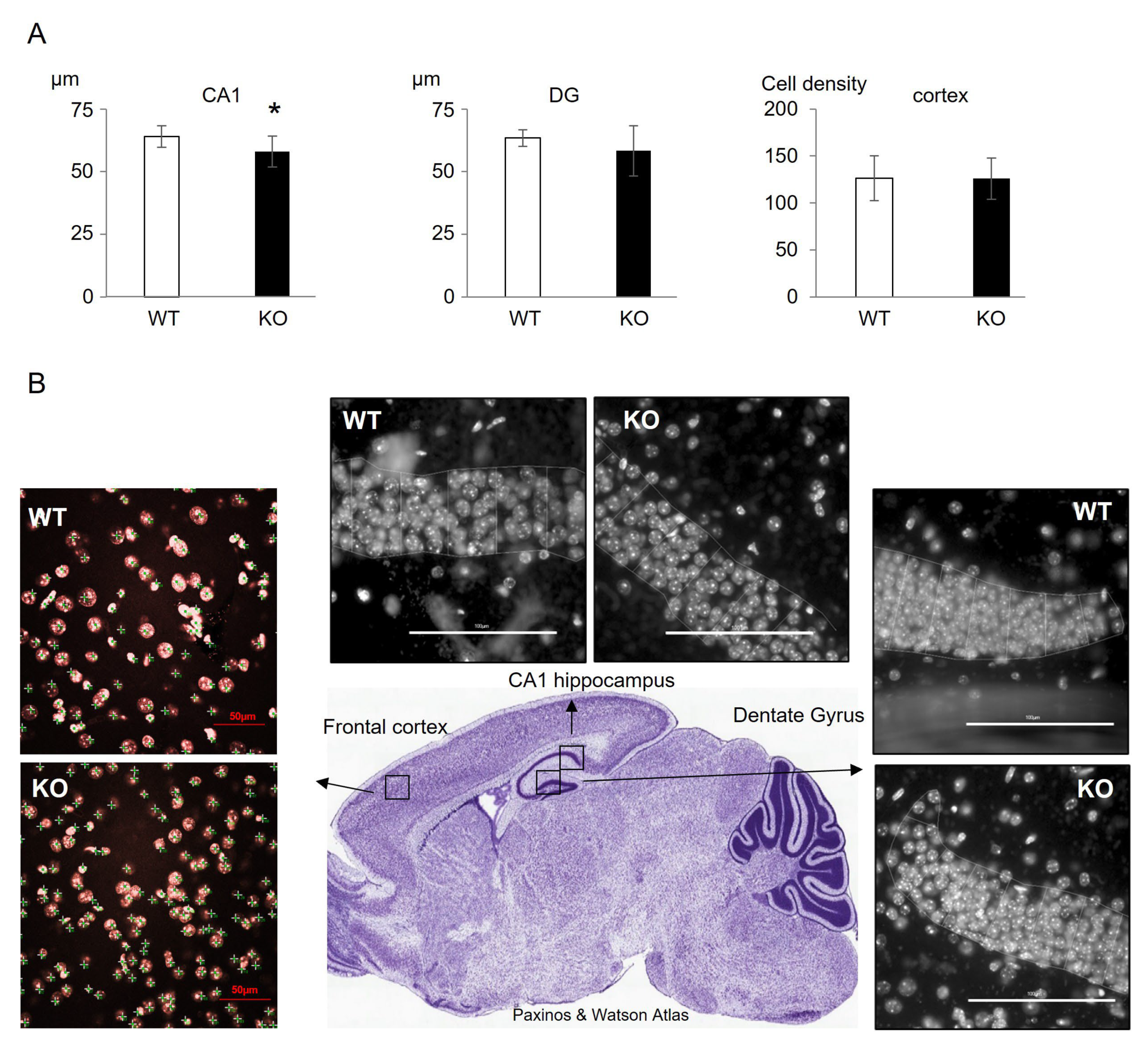 Cells 12 01267 g004 550