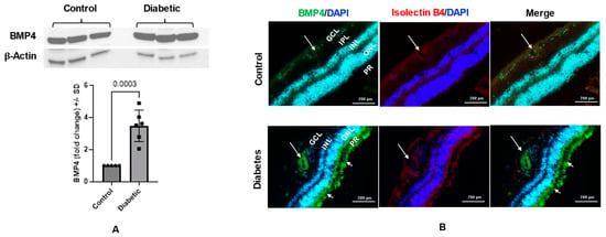 Cells | Free Full-Text | Bone Morphogenetic Protein-4 Impairs Retinal ...