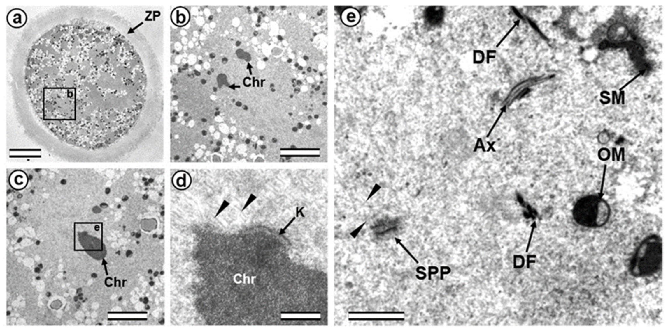 Cells 12 01335 g005 Cells 12 01335 g005