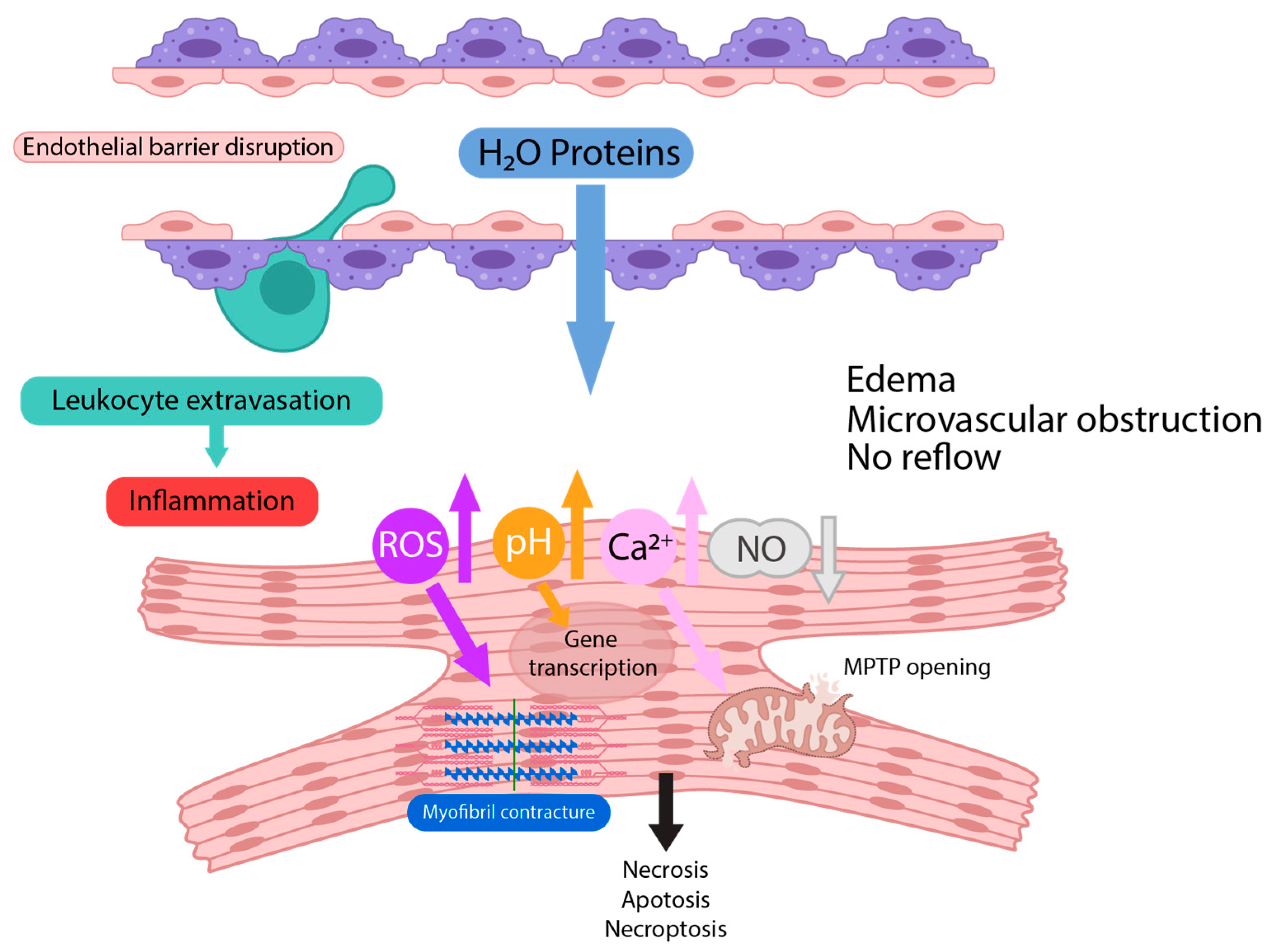 Cells | Free Full-Text | Microvascular Leakage as Therapeutic Target for  Ischemia and Reperfusion Injury