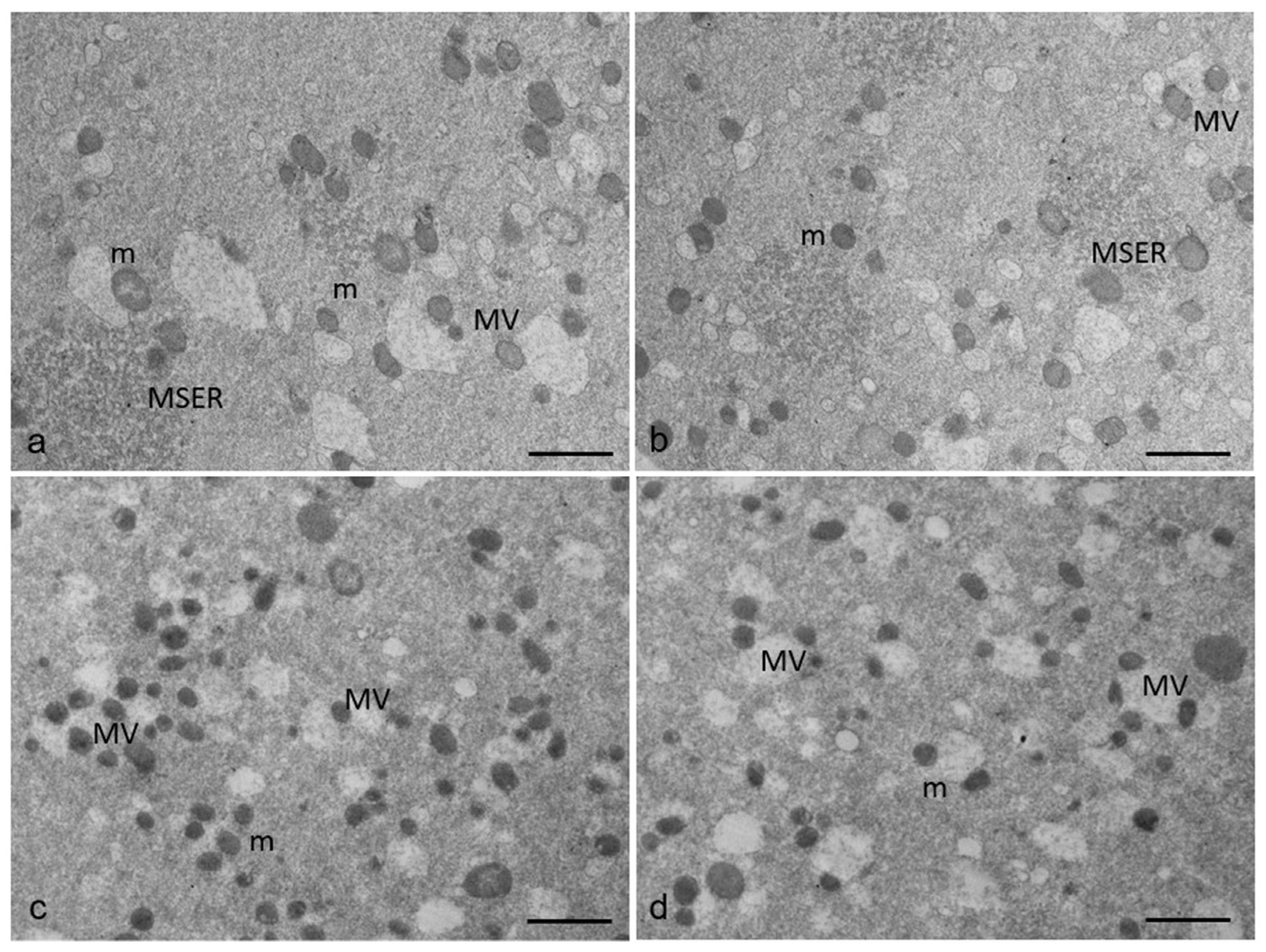 Cells 12 01346 g002 Cells 12 01346 g002