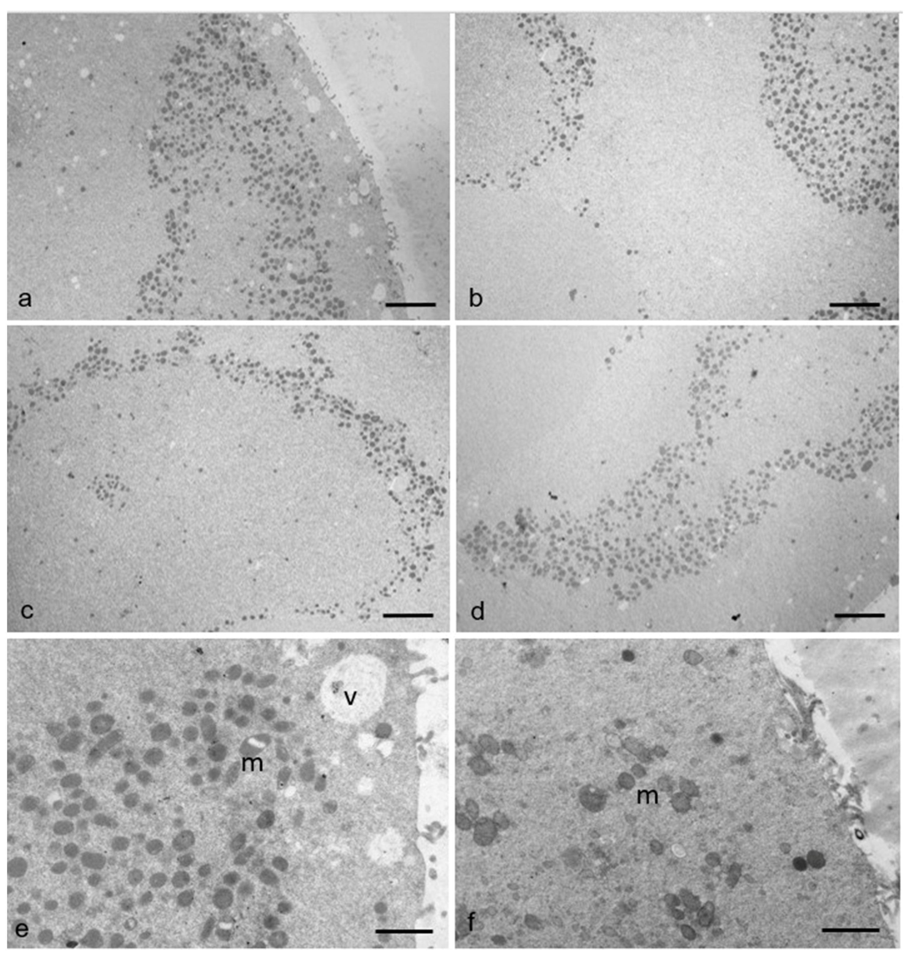 Cells 12 01346 g006 Cells 12 01346 g006