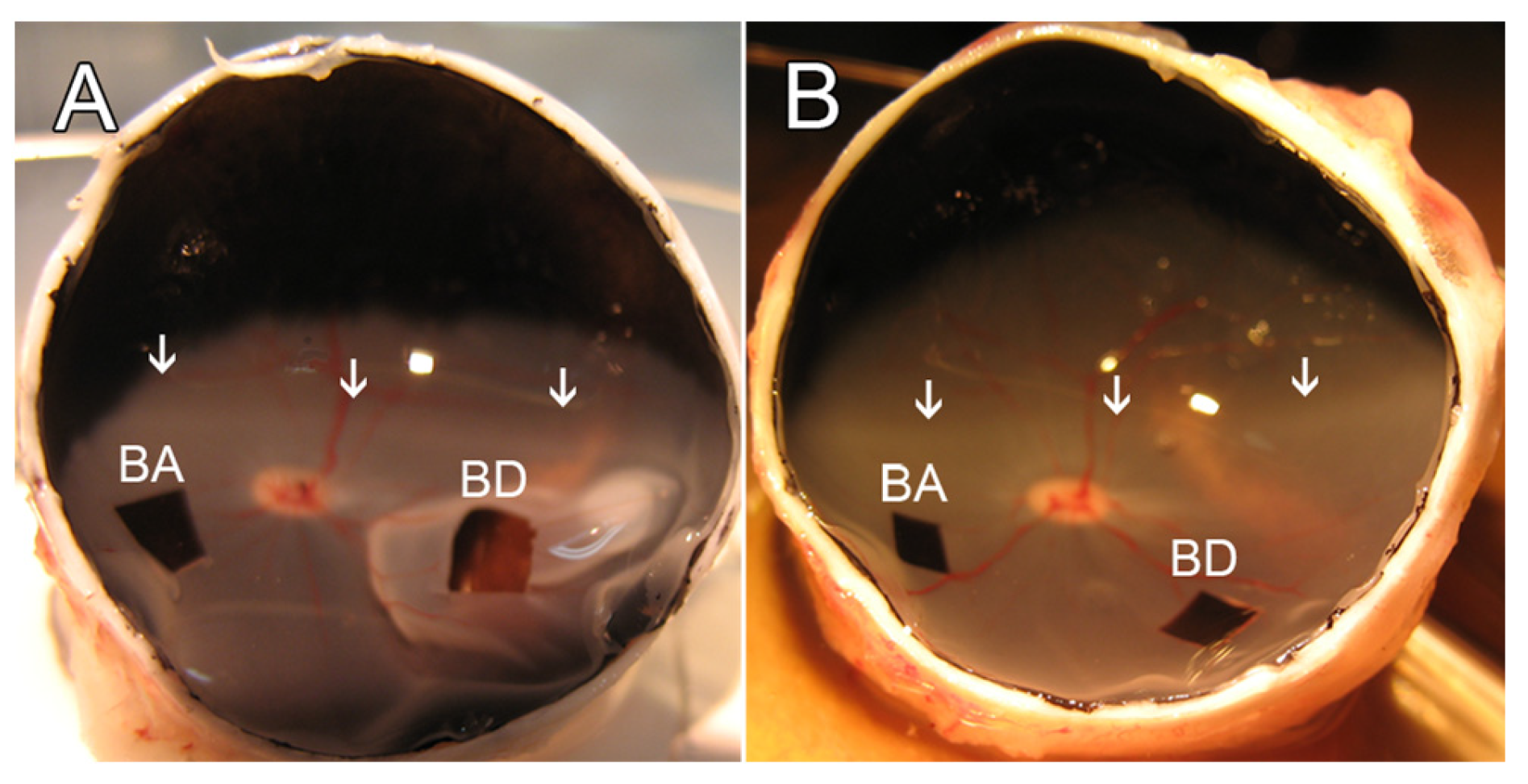 Layers of the Retina - Discovery Eye Foundation