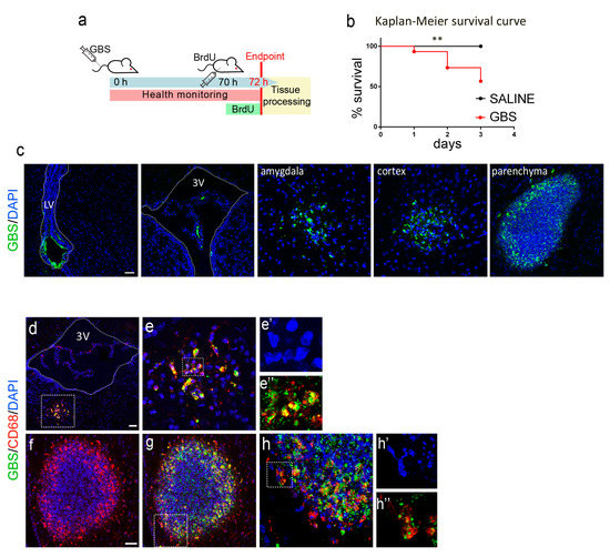 Brain Infection by Group B Streptococcus Induces