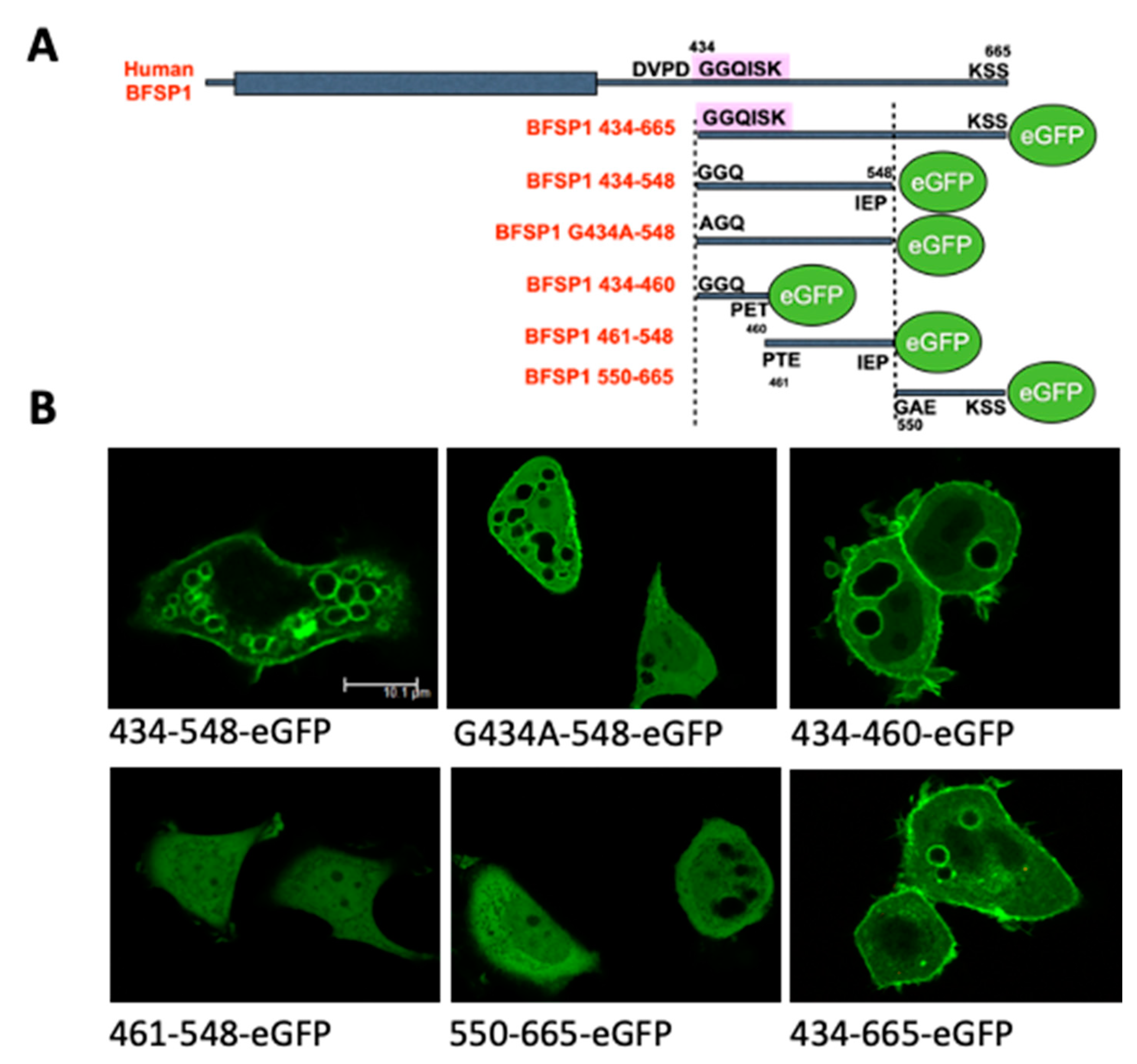Cells 12 01580 g005 Cells 12 01580 g005