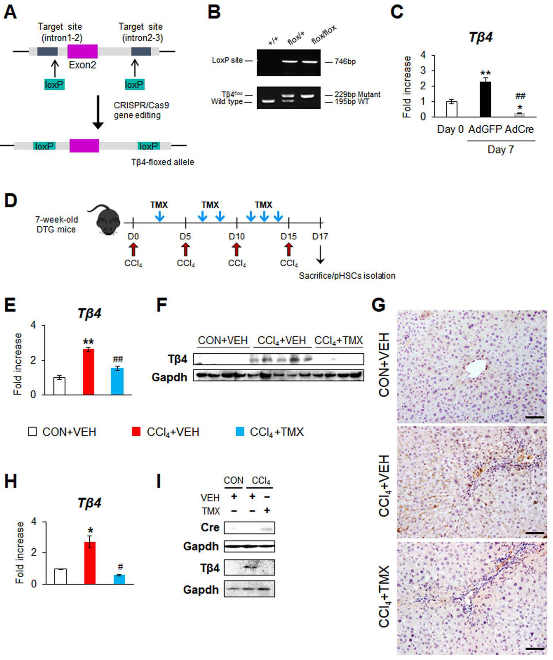Cells Free Full-Text Targeted Deletion of Thymosin Beta 4 in Hepatic Stellate Cells Ameliorates Liver Fibrosis in a Transgenic Mouse Model