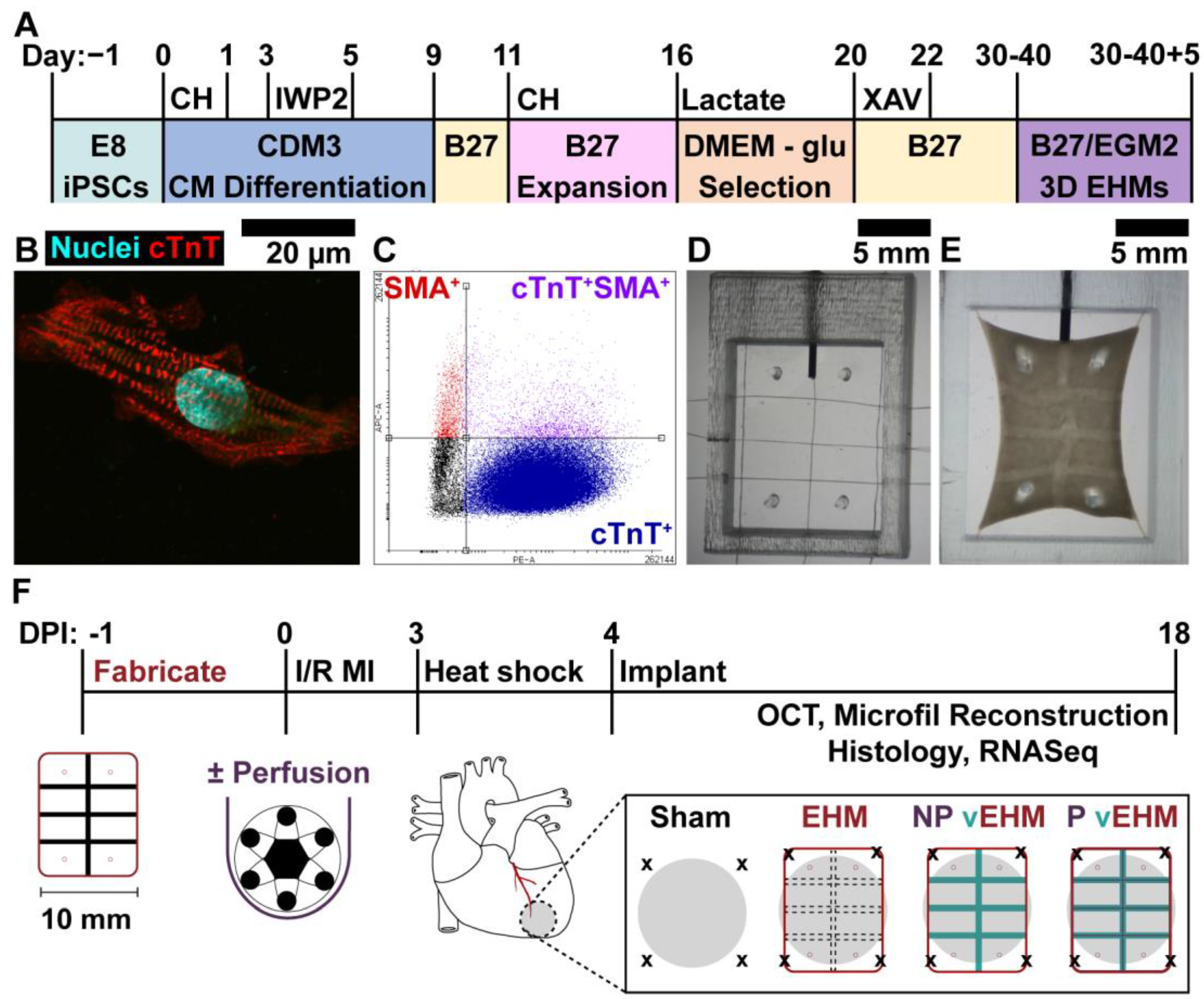 Cells Free Full-Text Patterned Arteriole-Scale Vessels Enhance Engraftment, Perfusion, and Vessel Branching Hierarchy of Engineered Human Myocardium for Heart Regeneration